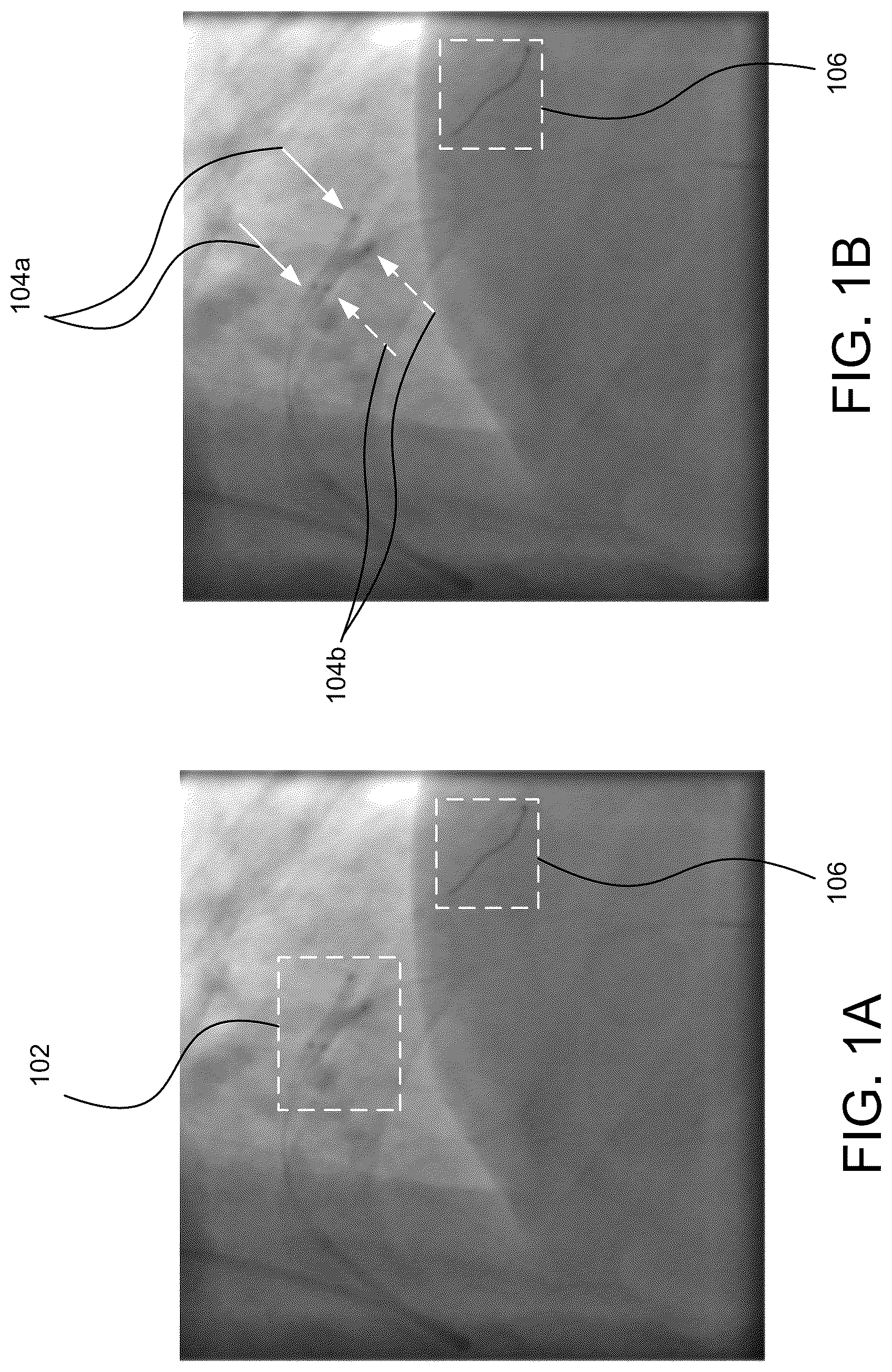 Patent US12322088 — Detecting and enhancing objects in medical images — Figure 1