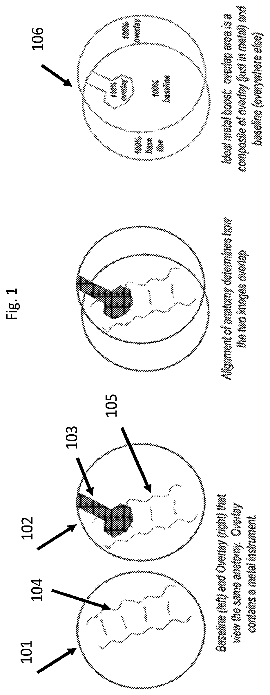 Patent US12322095 Figure 1 – Adjusting appearance of objects in medical images