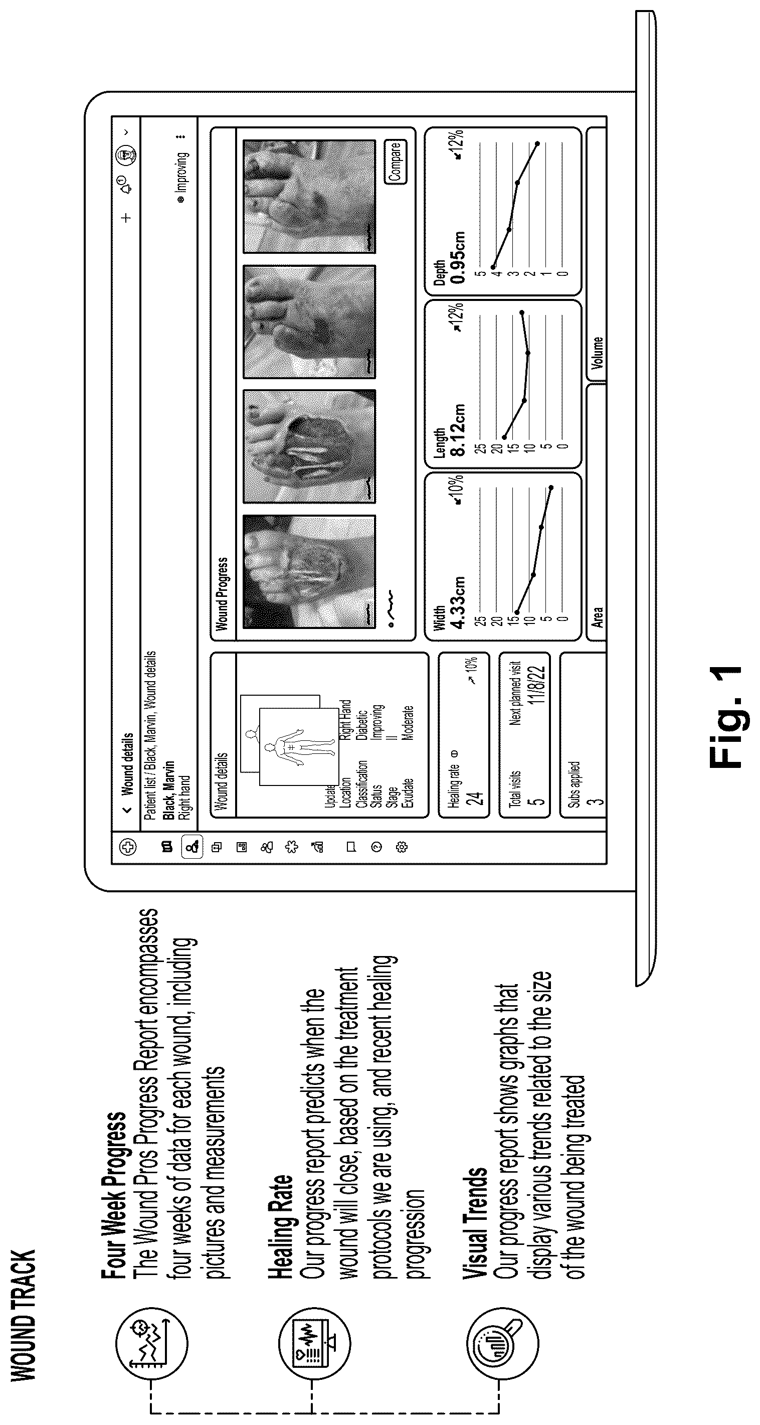 Patent US12322109 Figure 1 – Methods and systems for improving wound healing