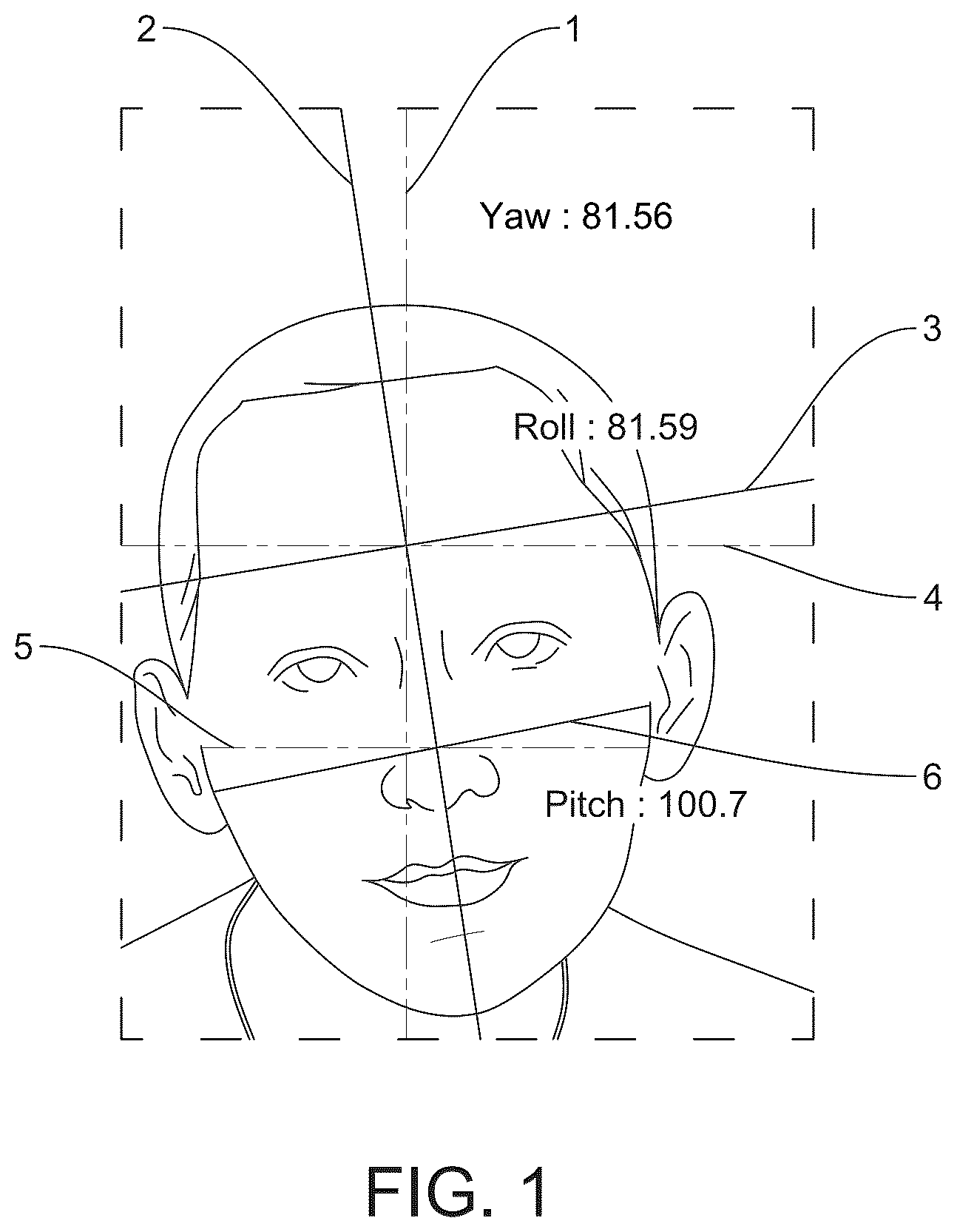 Patent US12322133 — Devices, systems and methods for precise human head positioning — Figure 1
