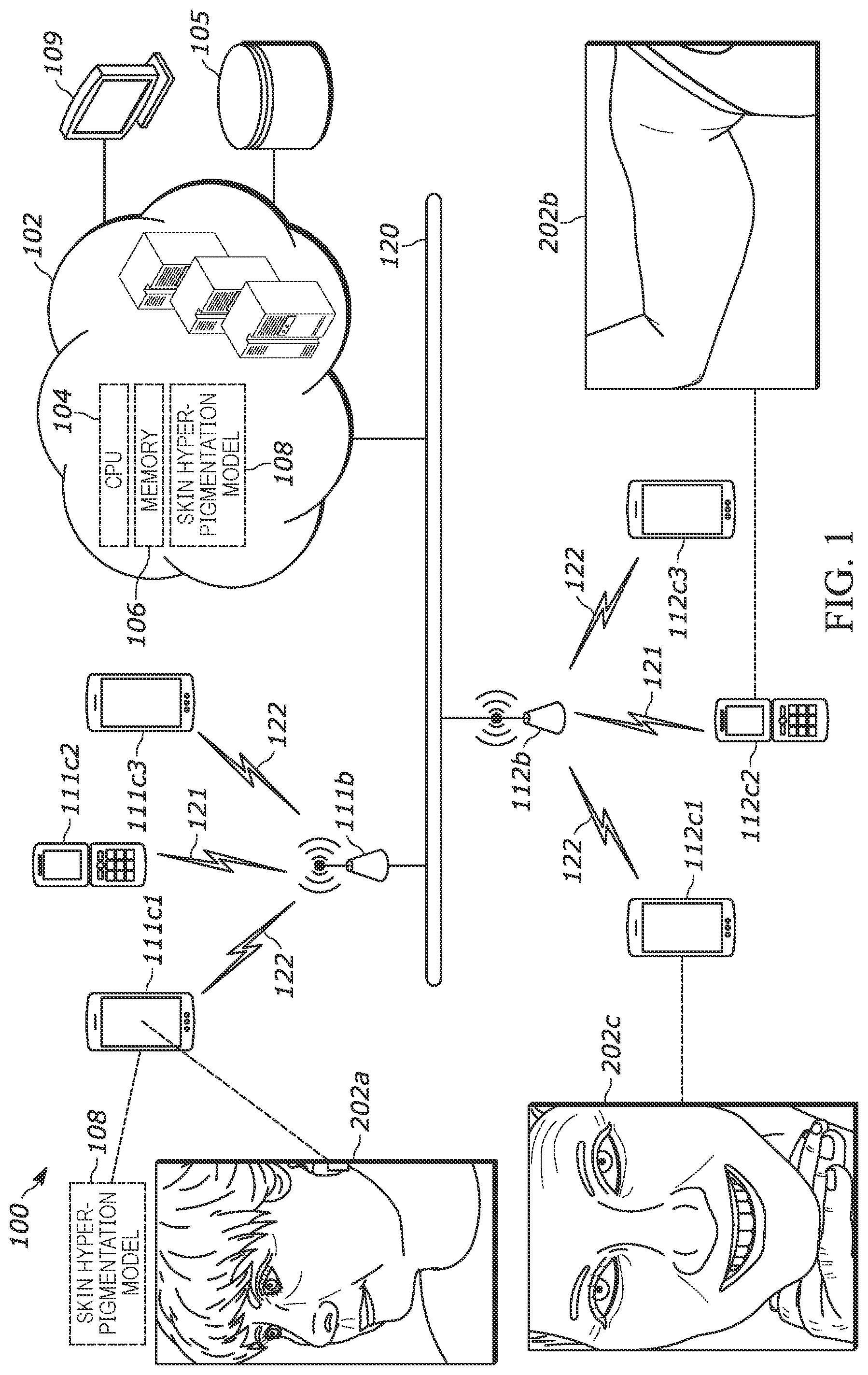 Patent US12322201 Figure 1 – Digital imaging systems and methods of analyzing pixel data of an image of a skin area of a user for determining skin hyperpigmentation