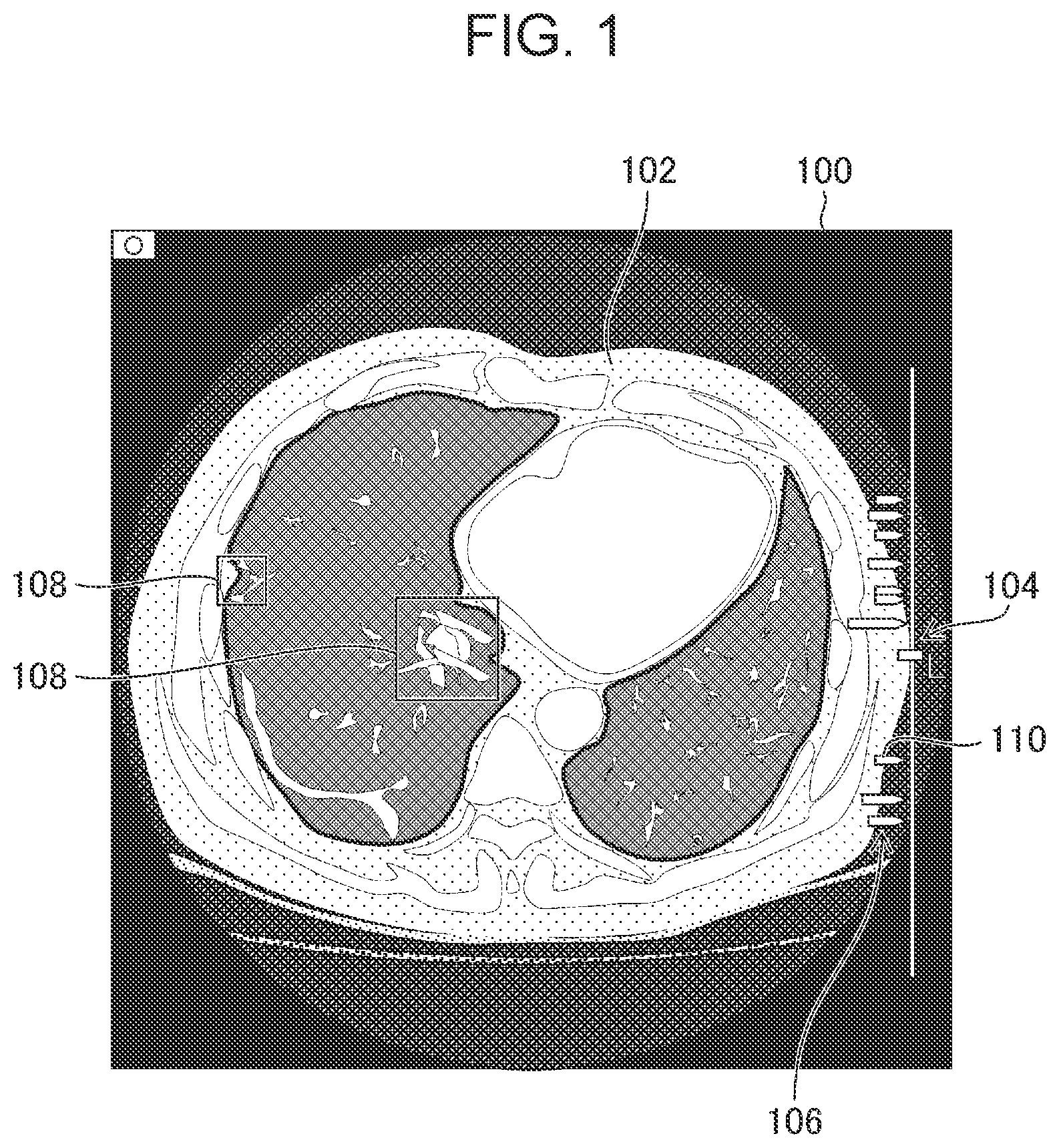 Patent US12322498 — Image processing apparatus, image display system, image processing method, and program for displaying information associated with region of interest of medical image — Figure 1