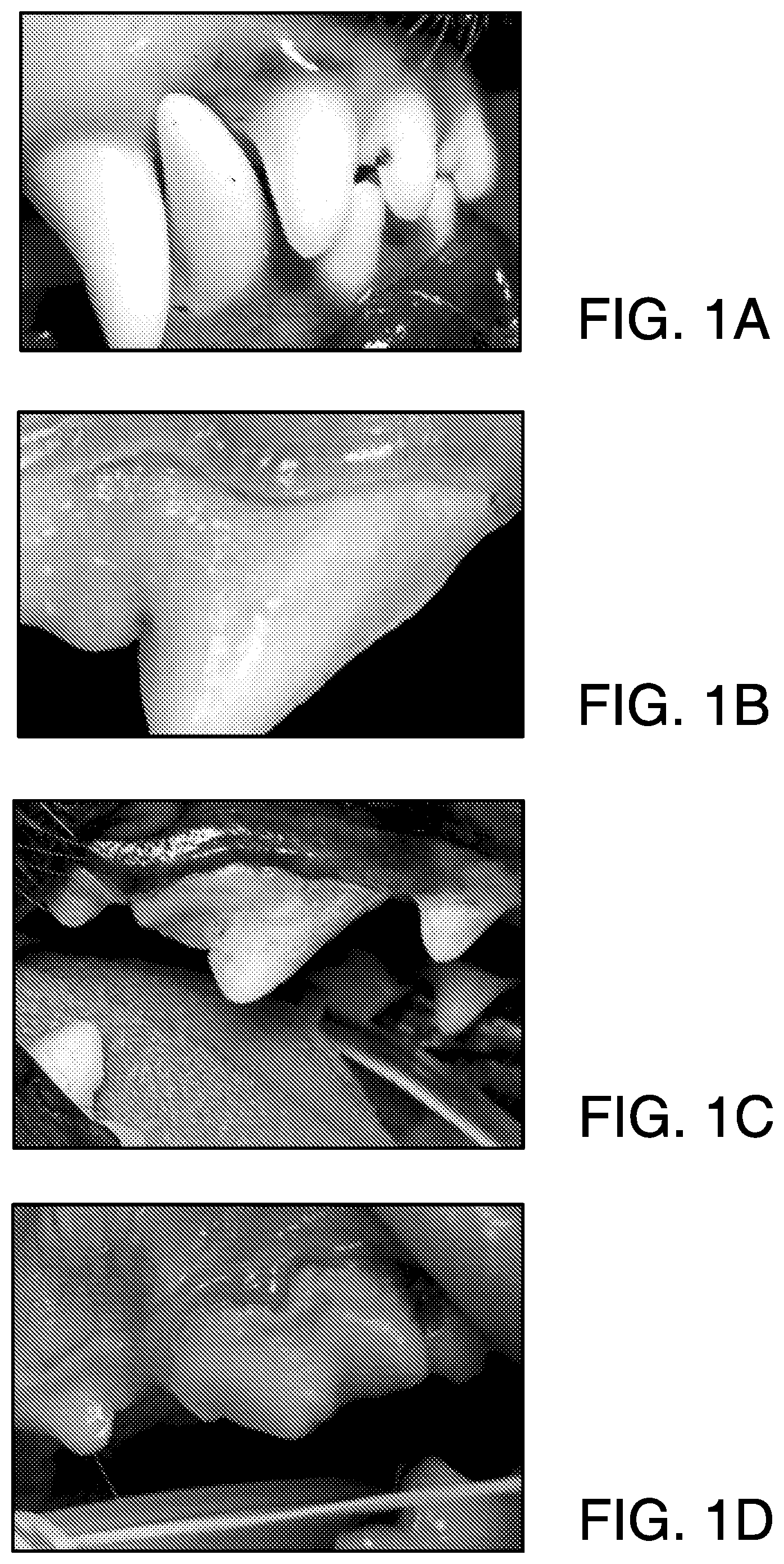 Patent US12322513 Figure 1 – Method or system for diagnosing periodontal disease