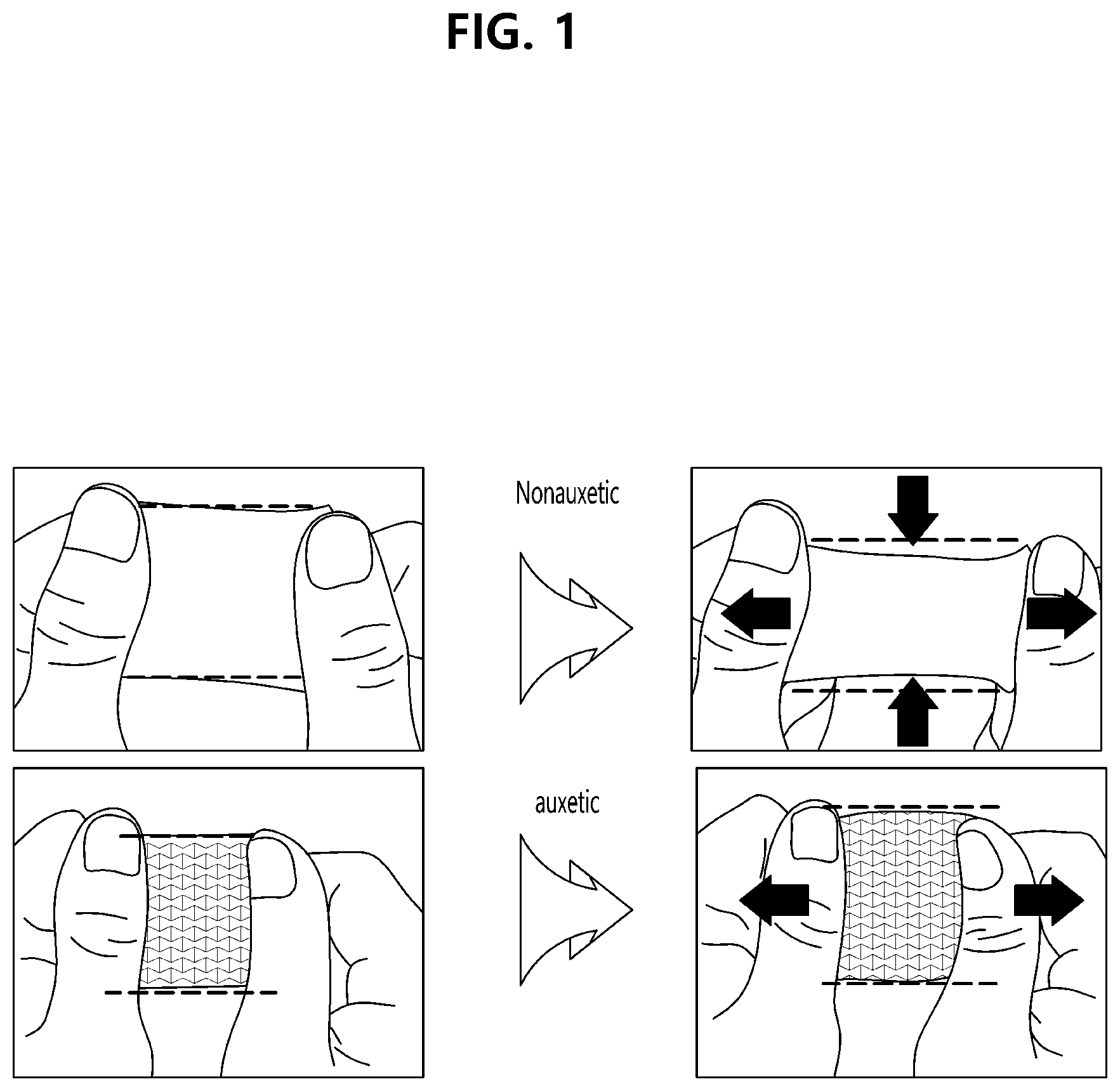 Patent US12324095 Figure 1 – Auxetic stretchable substrate with flexible joint structure and method of manufacturing same