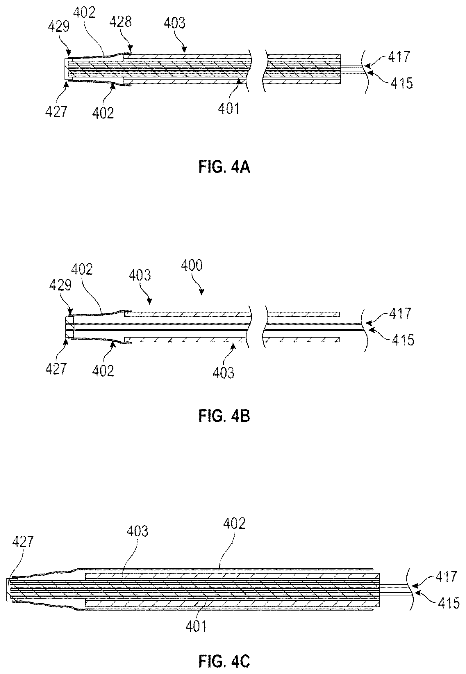 Patent US12324565 Figure 3 – Methods of attaching a rigidizing sheath to an endoscope