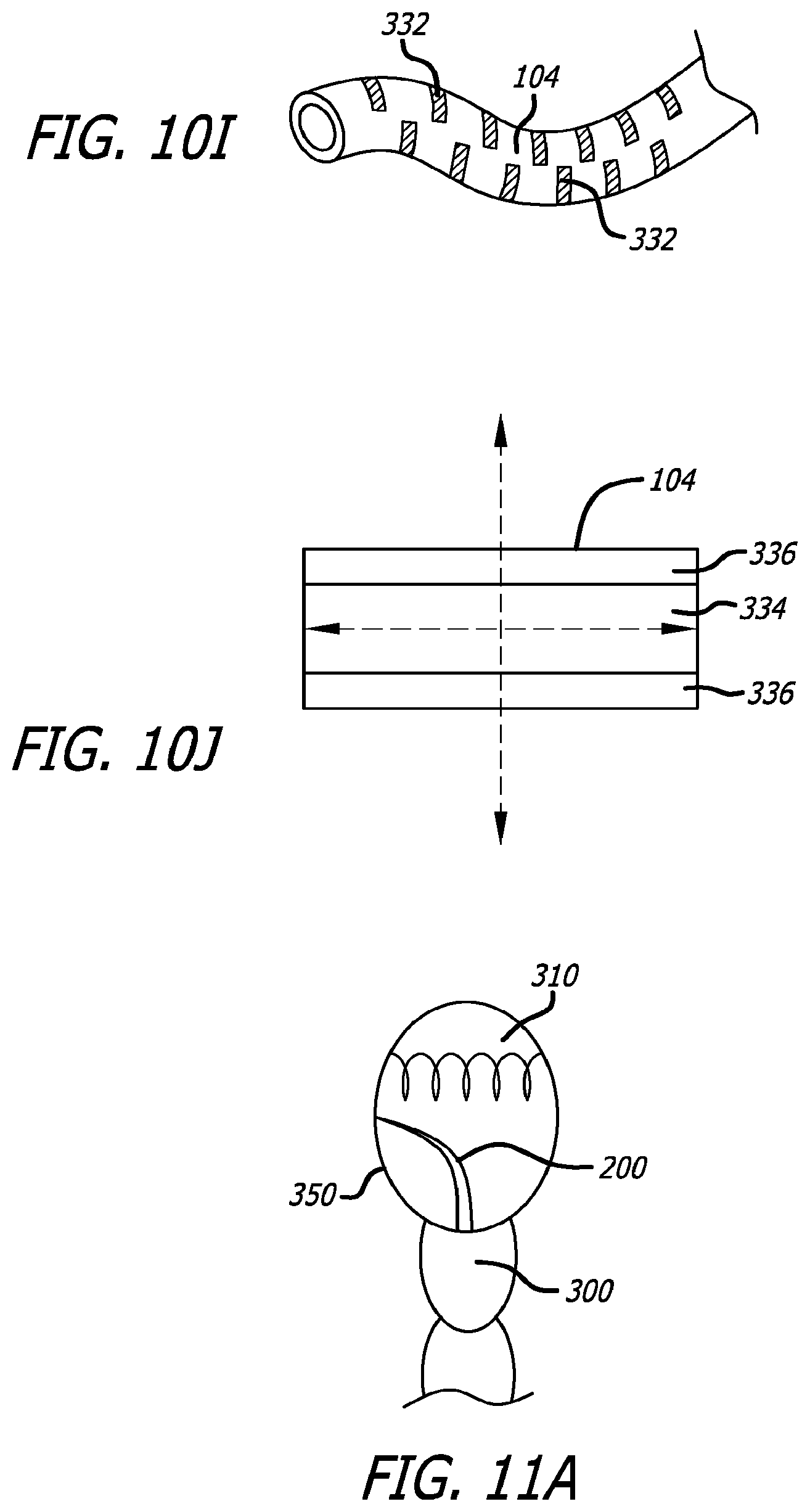 Patent US12324576 Figure 11 – Flexible system for delivering an anchor