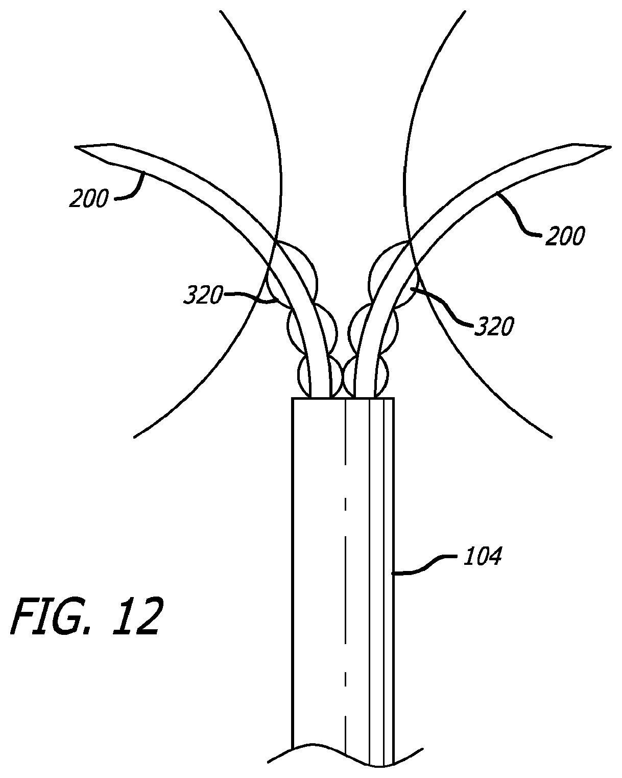 Patent US12324576 Figure 13 – Flexible system for delivering an anchor