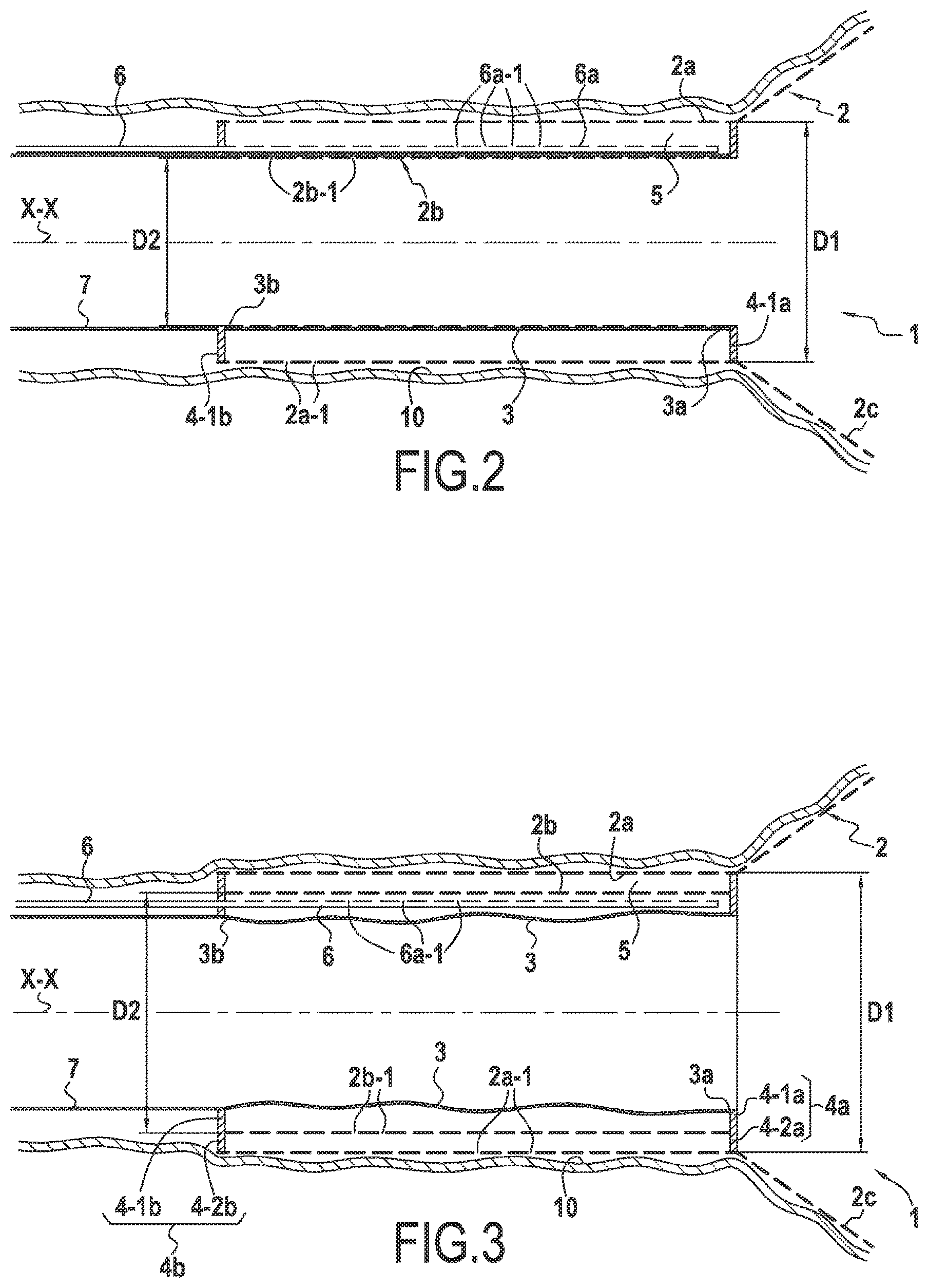 Patent US12324584 Figure 2 – Surgical device for controlled anchoring in the intestine