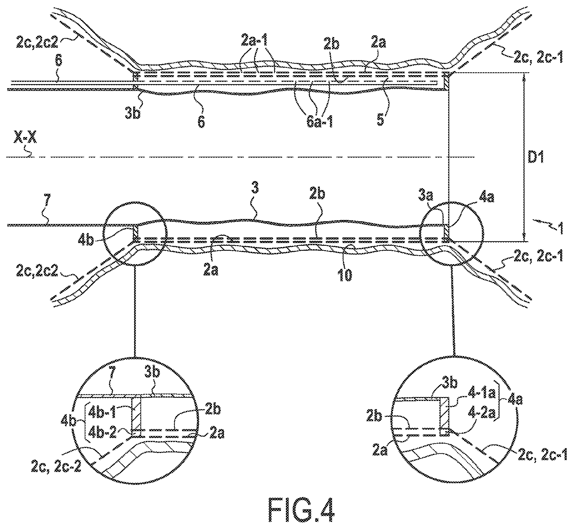 Patent US12324584 Figure 3 – Surgical device for controlled anchoring in the intestine