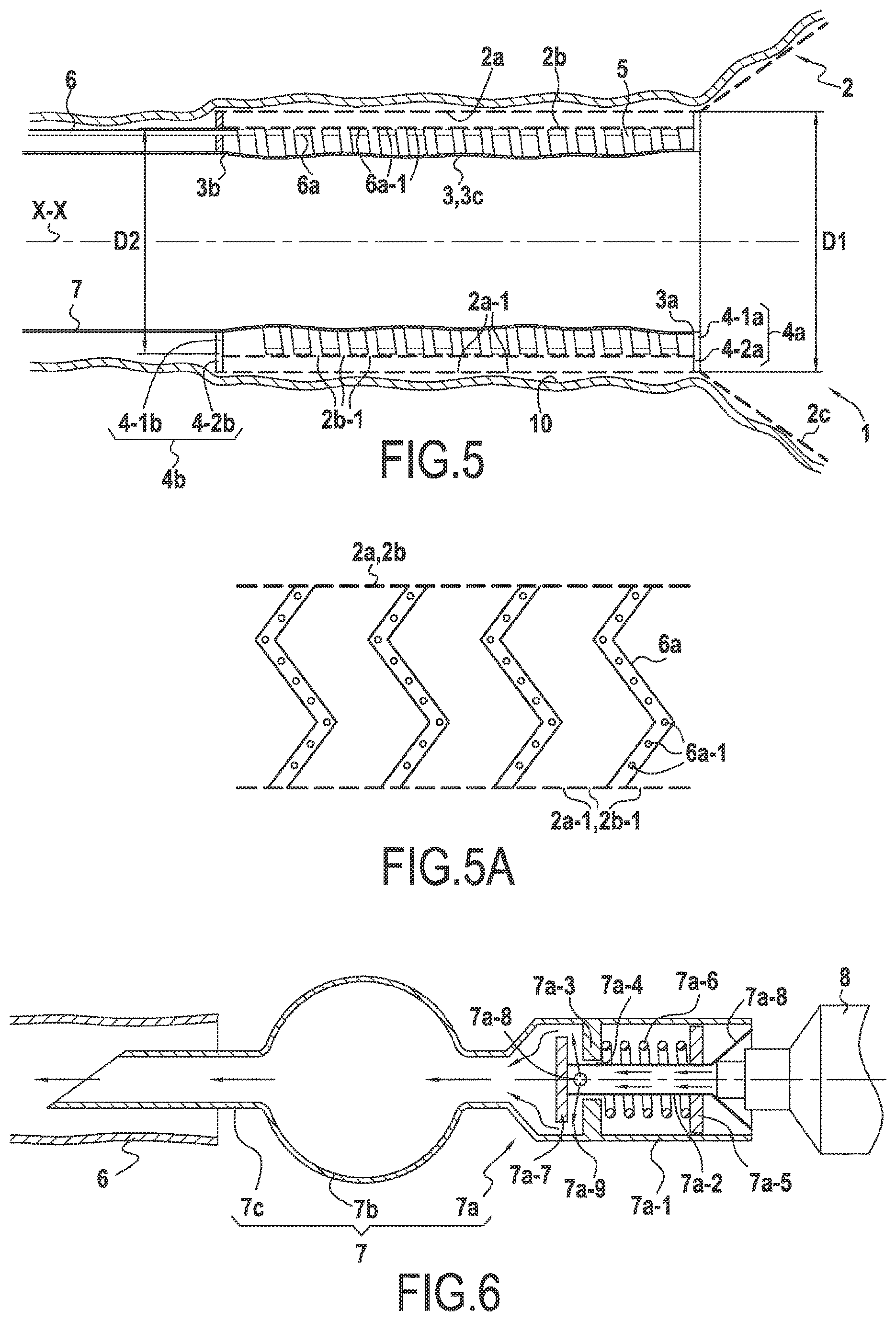Patent US12324584 Figure 4 – Surgical device for controlled anchoring in the intestine