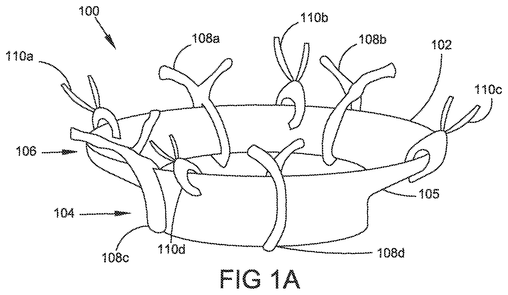 Patent US12324586 — Apparatus and methods for managing a shape of a junction between a bladder and urethra — Figure 1