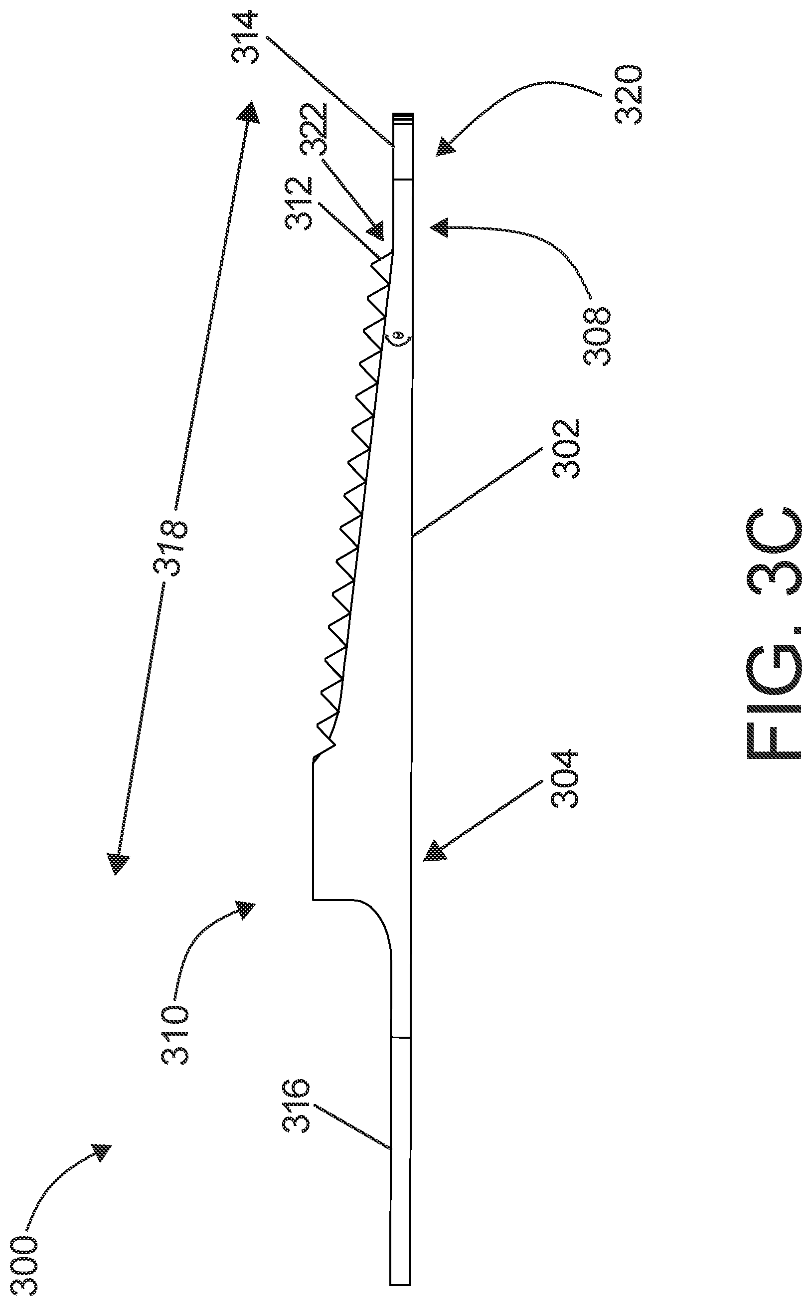 Patent US12324590 Figure 13 – Surgical instruments including a set of cutting burrs for performing an osteotomy