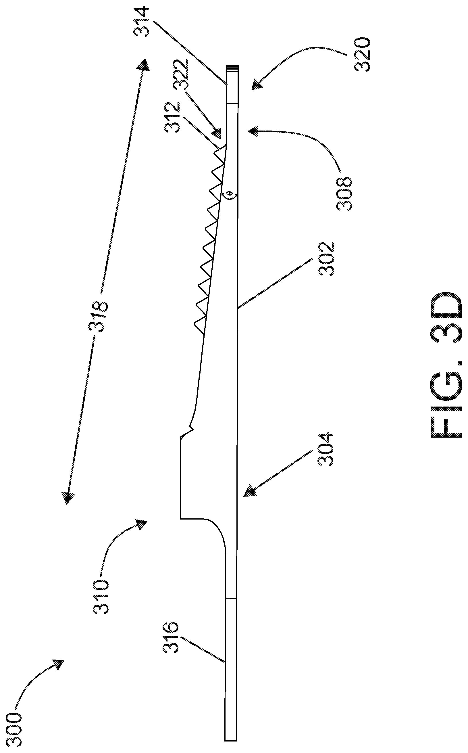 Patent US12324590 Figure 14 – Surgical instruments including a set of cutting burrs for performing an osteotomy