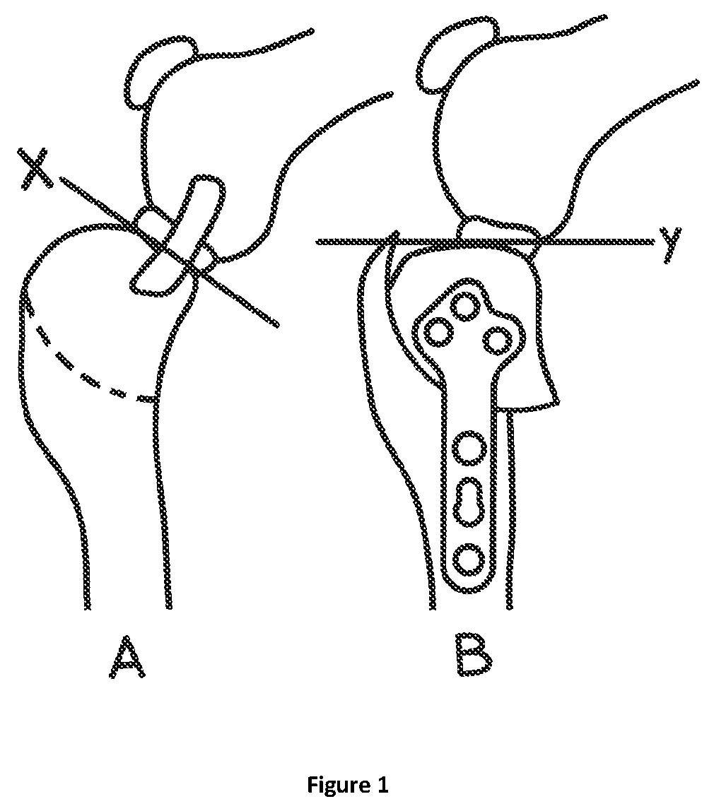Patent US12324592 — Veterinary surgical guide — Figure 1