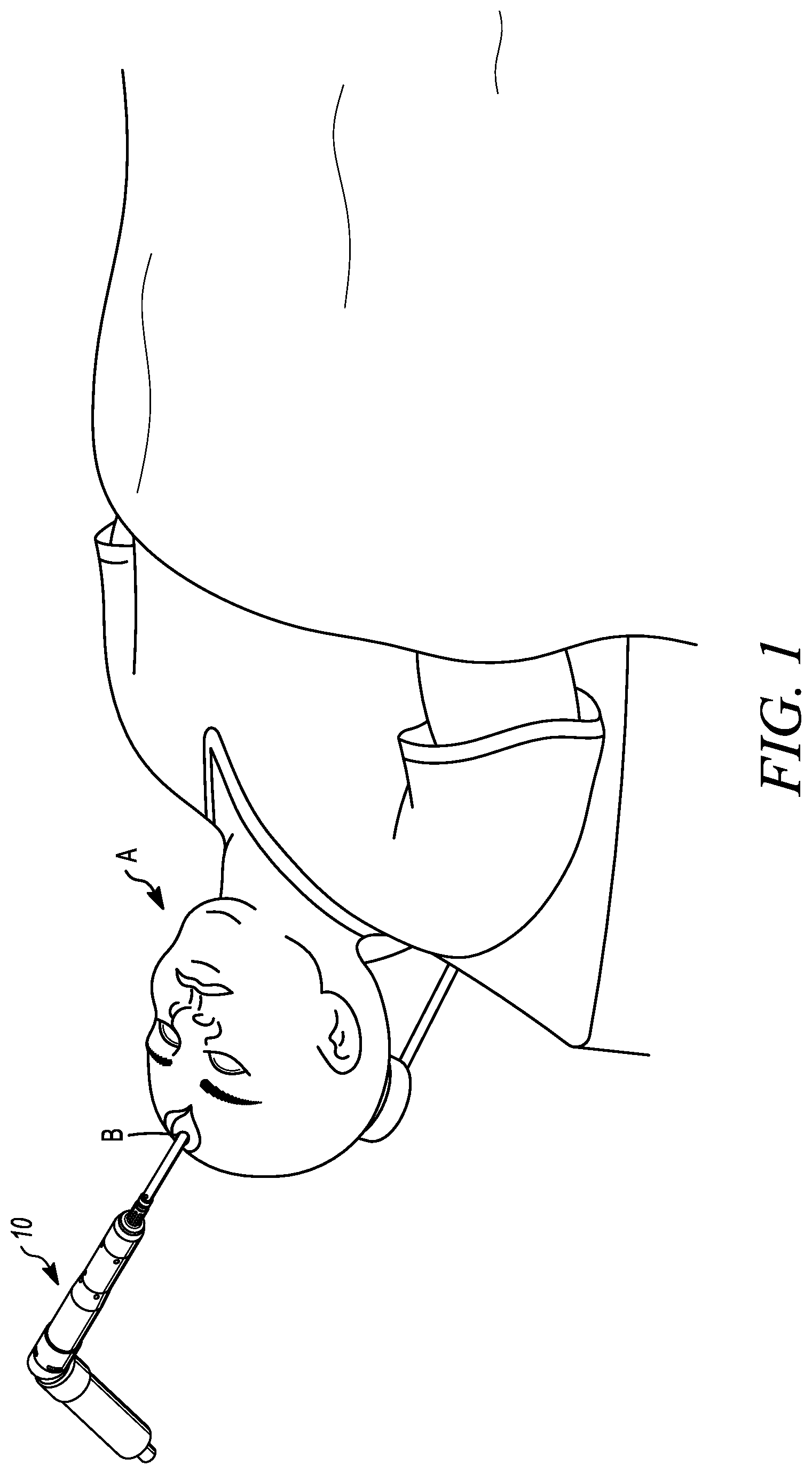 Patent US12324594 — Ultrasonic bone cutting device with integrated sensing — Figure 1