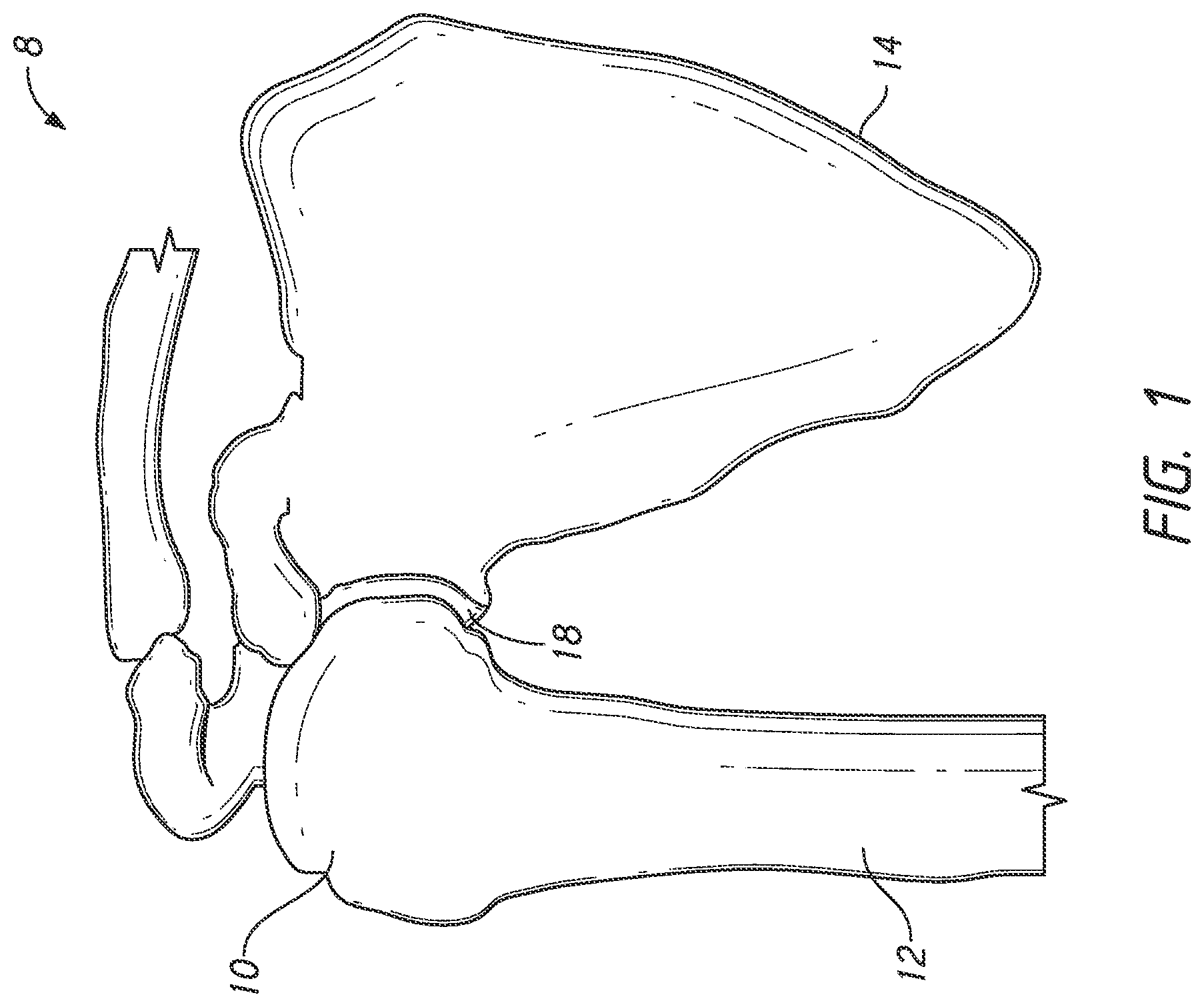 Patent US12324598 — Guides and instruments for improving accuracy of glenoid implant placement — Figure 1
