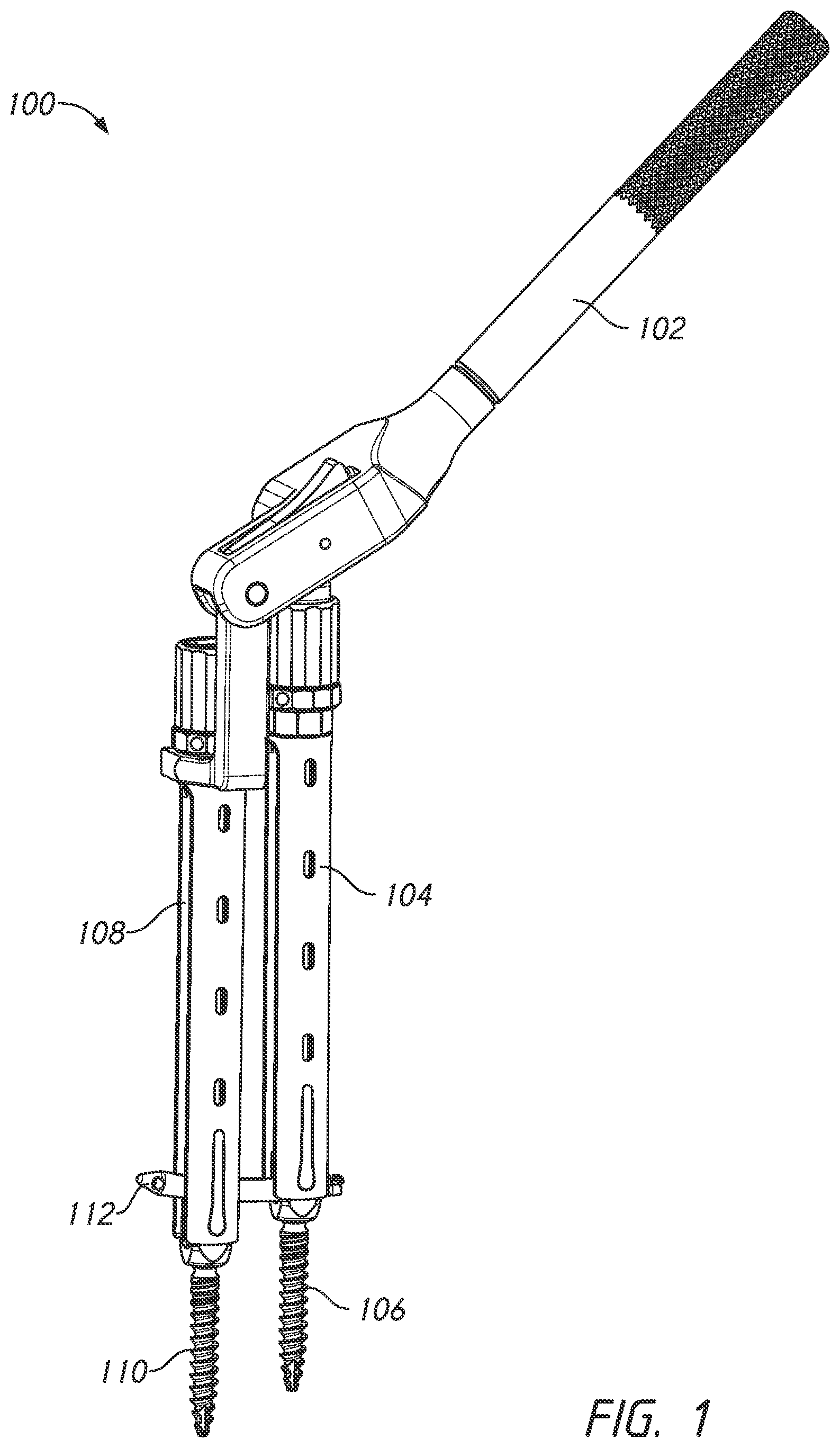 Patent US12324610 Figure 1 – Lever reducer