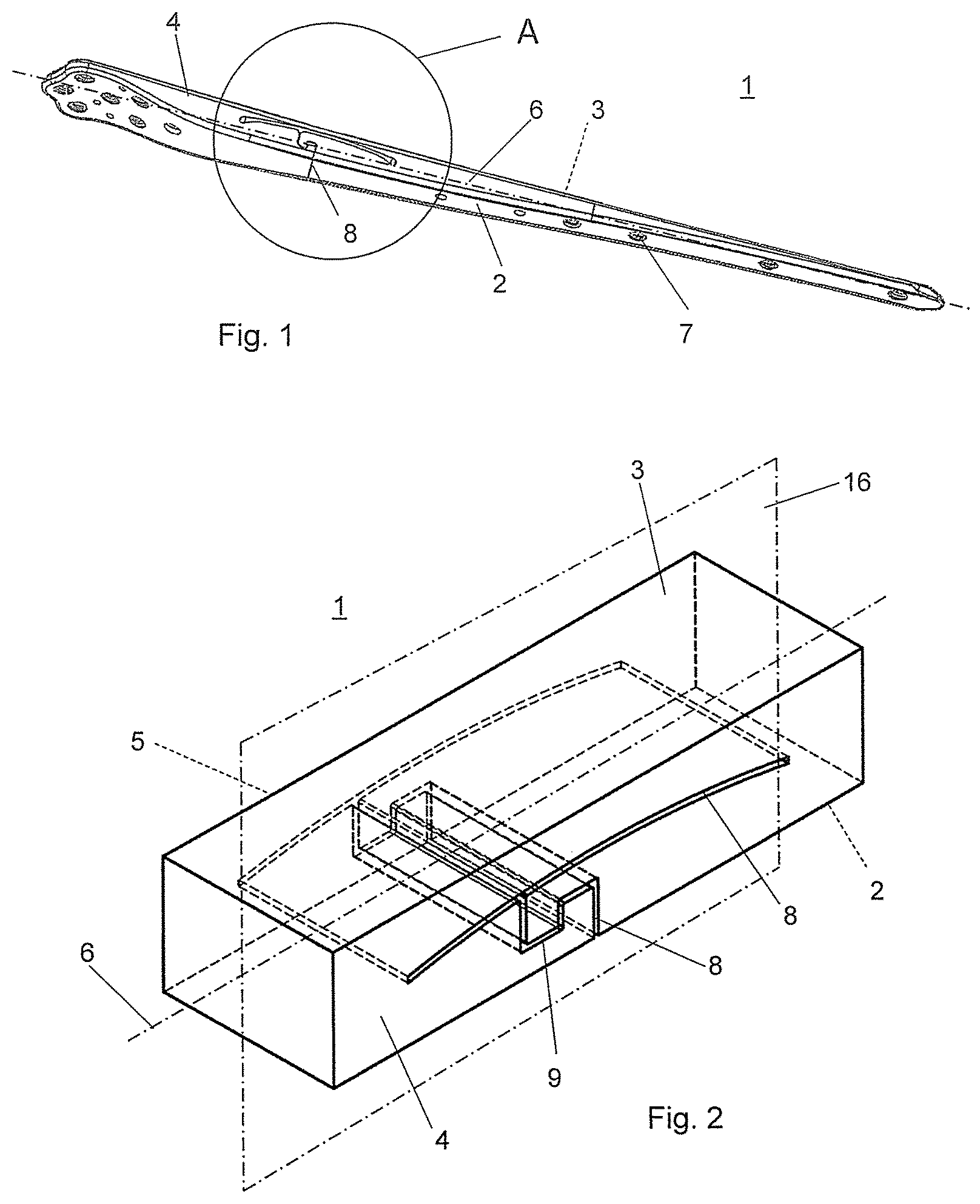 Patent US12324613 Figure 1 – Biphasic bone plate