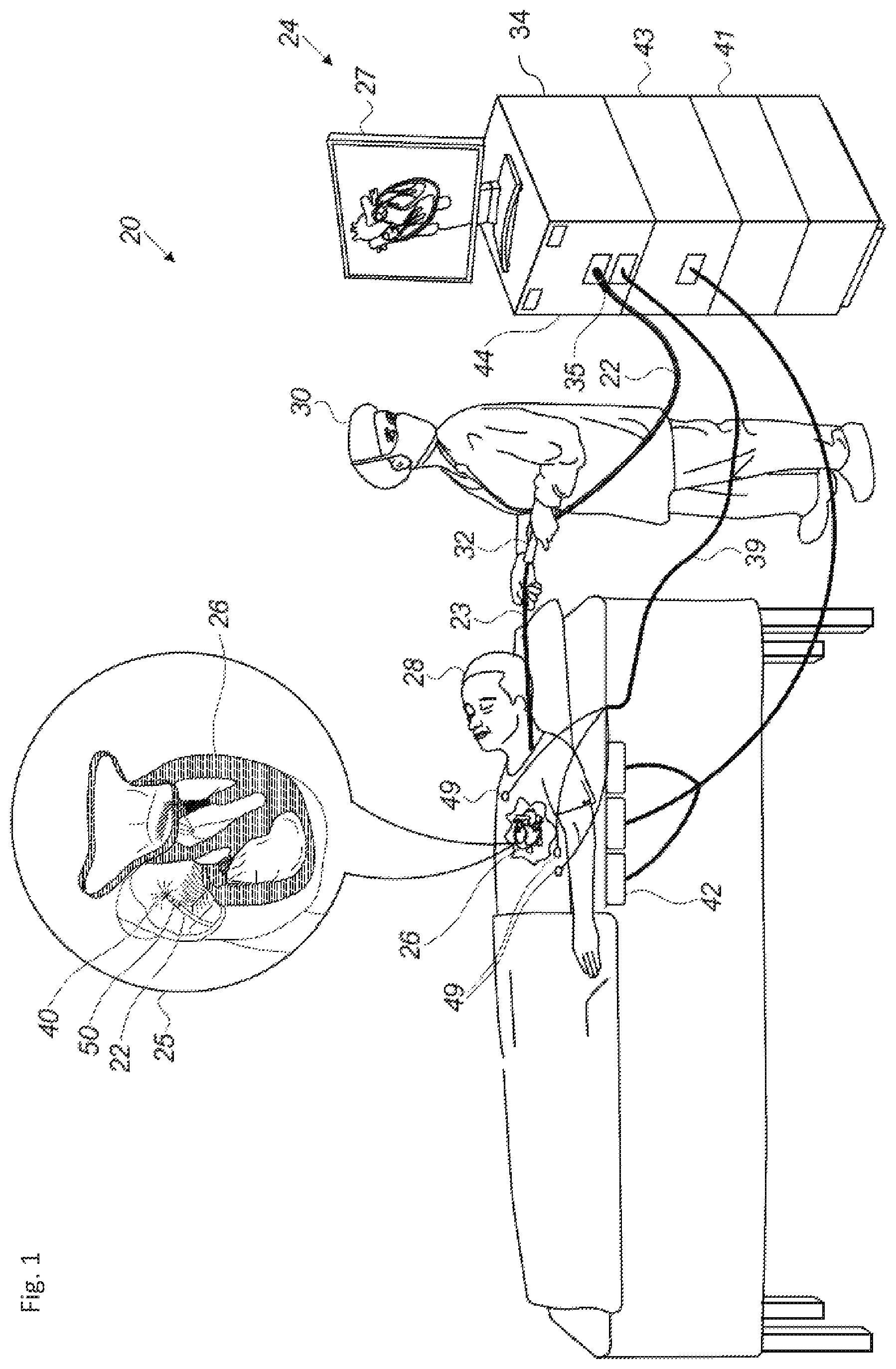 Patent US12324619 — Automatic anatomical feature identification and map segmentation — Figure 1