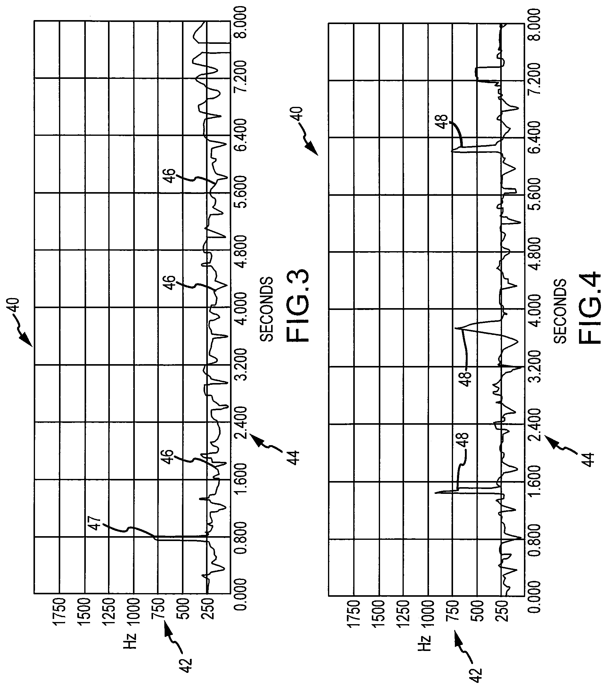 Patent US12324657 Figure 3 – System and method for diagnosis of bovine diseases using auscultation analysis