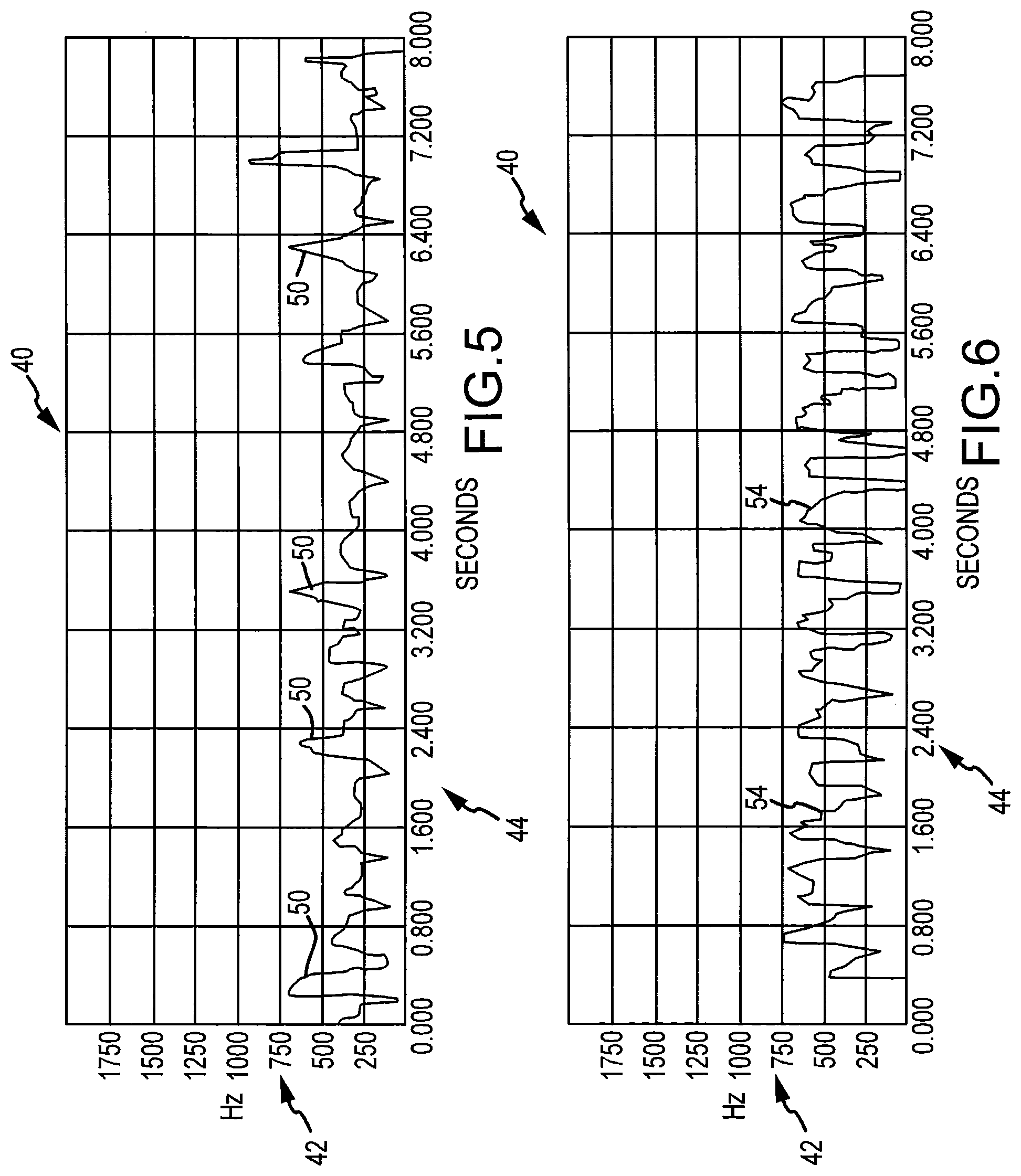 Patent US12324657 Figure 4 – System and method for diagnosis of bovine diseases using auscultation analysis