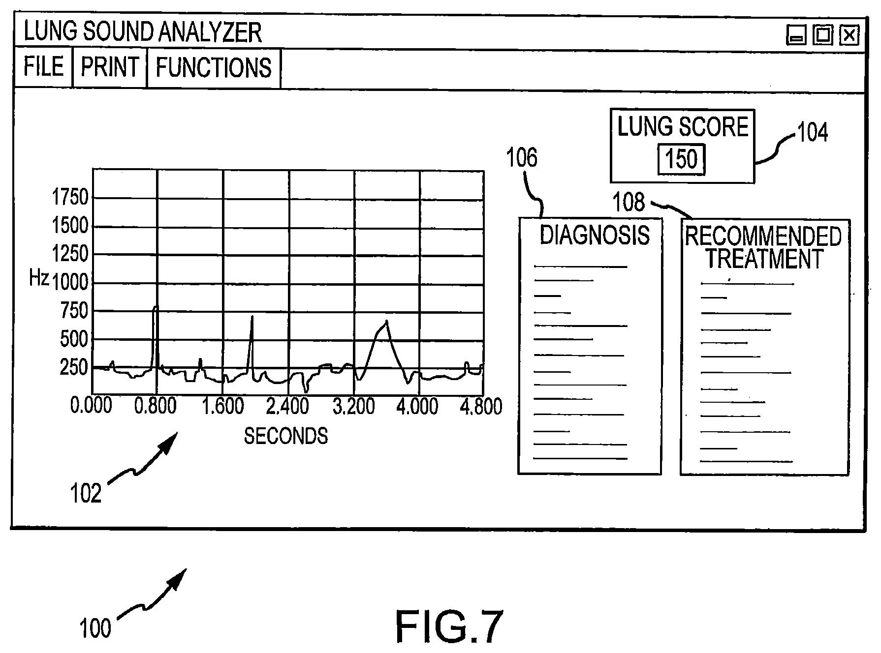 Patent US12324657 Figure 5 – System and method for diagnosis of bovine diseases using auscultation analysis