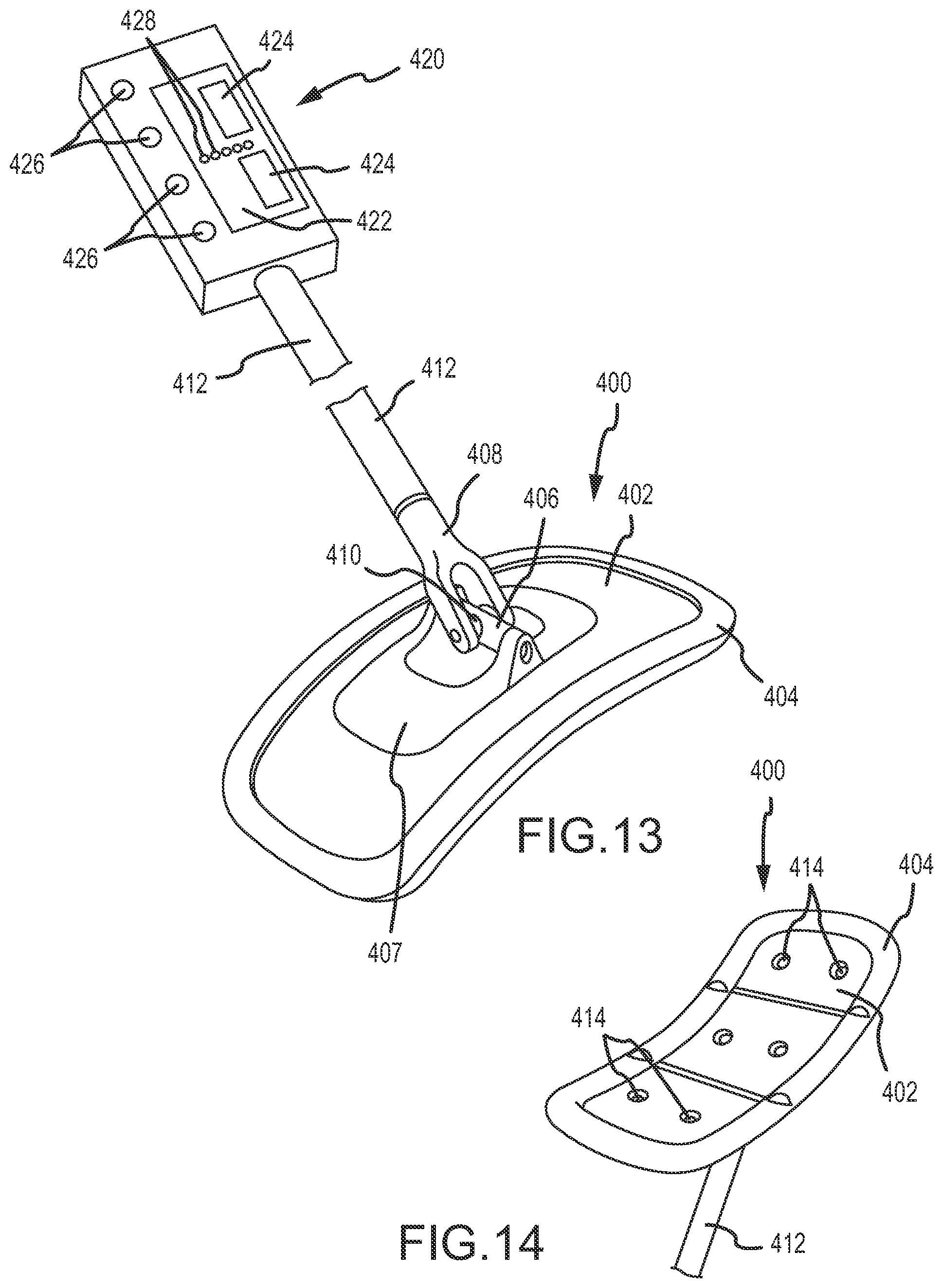 Patent US12324657 Figure 12 – System and method for diagnosis of bovine diseases using auscultation analysis