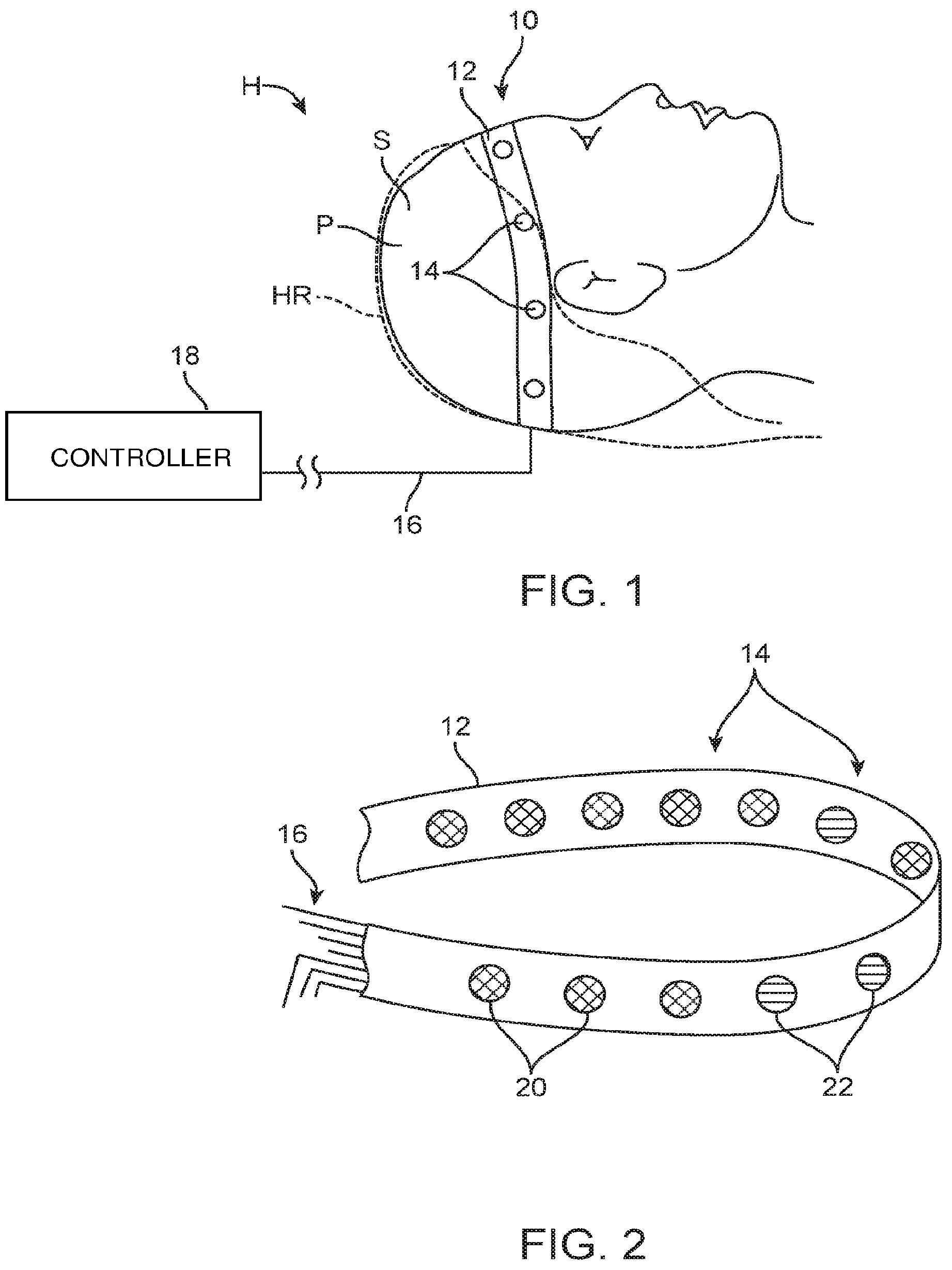 Patent US12324670 — Methods and apparatus for electrode placement and tracking — Figure 1