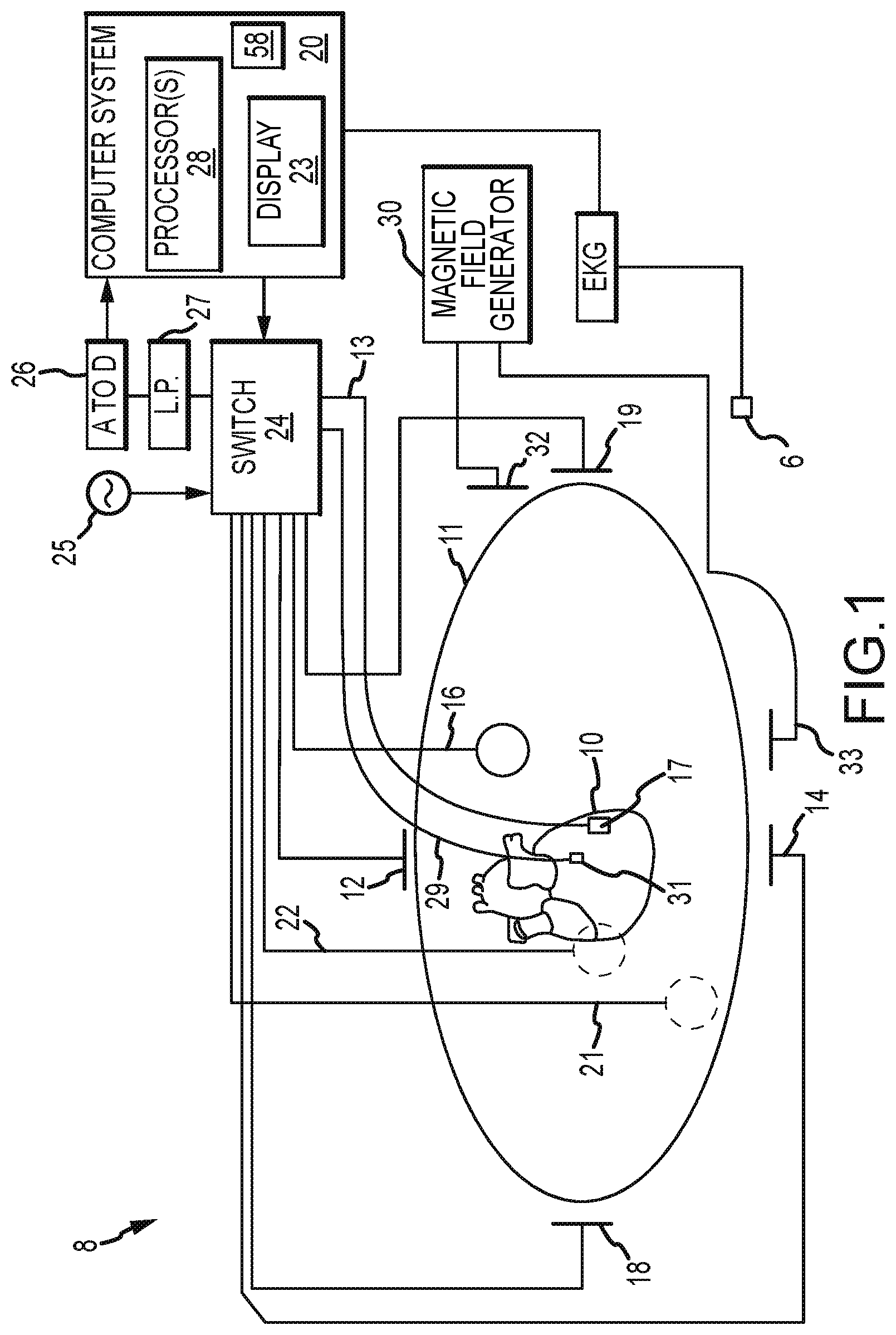 Patent US12324671 — System, method, and apparatus for mapping local activation times — Figure 1
