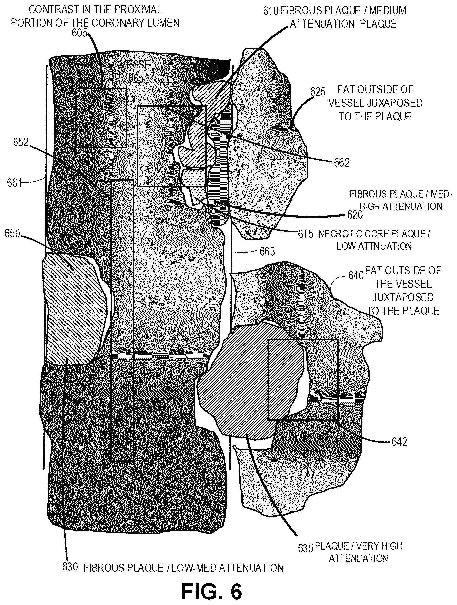 Patent US12324696 Figure 8 – Systems, devices, and methods for non-invasive image-based plaque analysis and risk determination