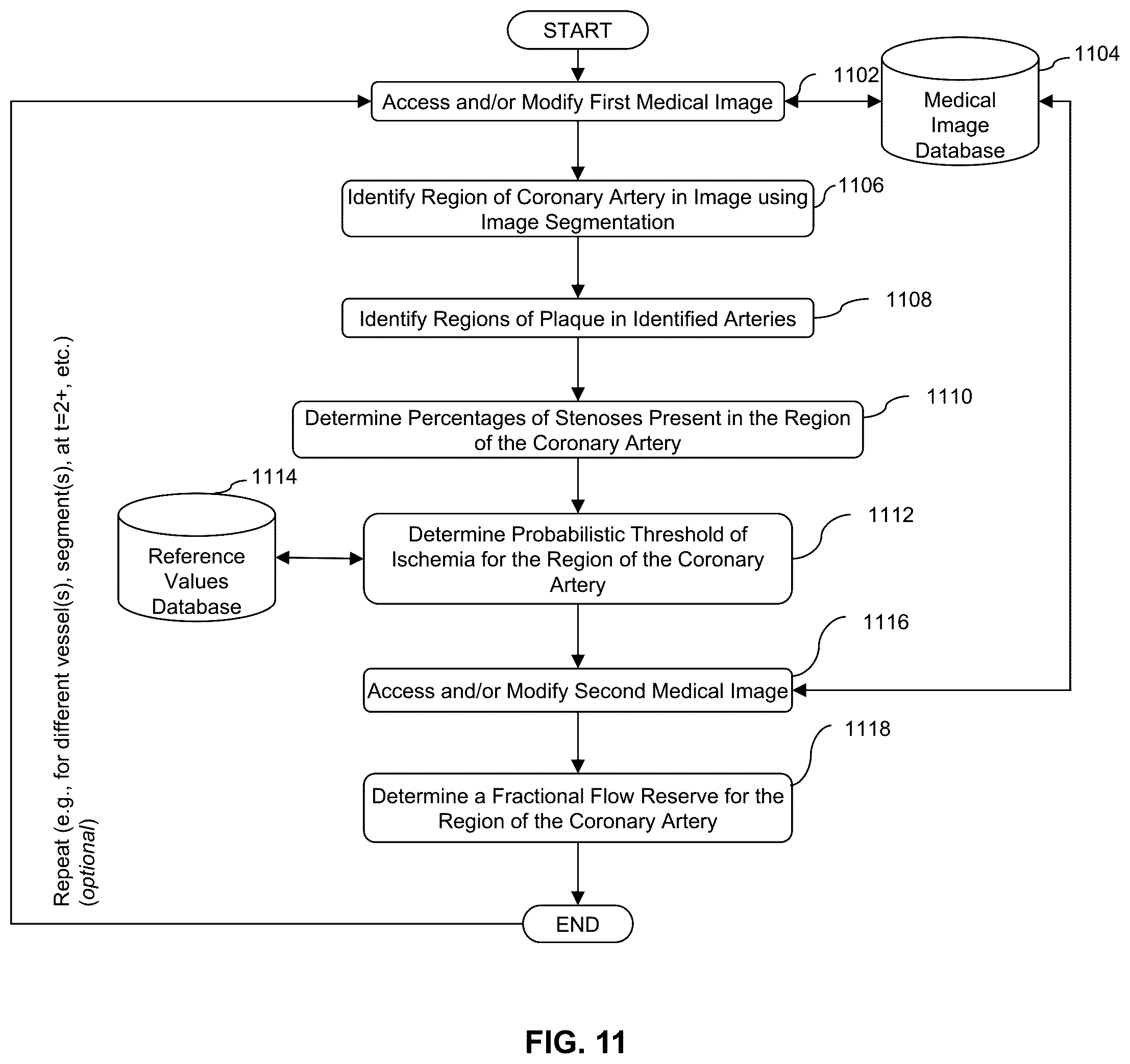 Patent US12324696 Figure 16 – Systems, devices, and methods for non-invasive image-based plaque analysis and risk determination
