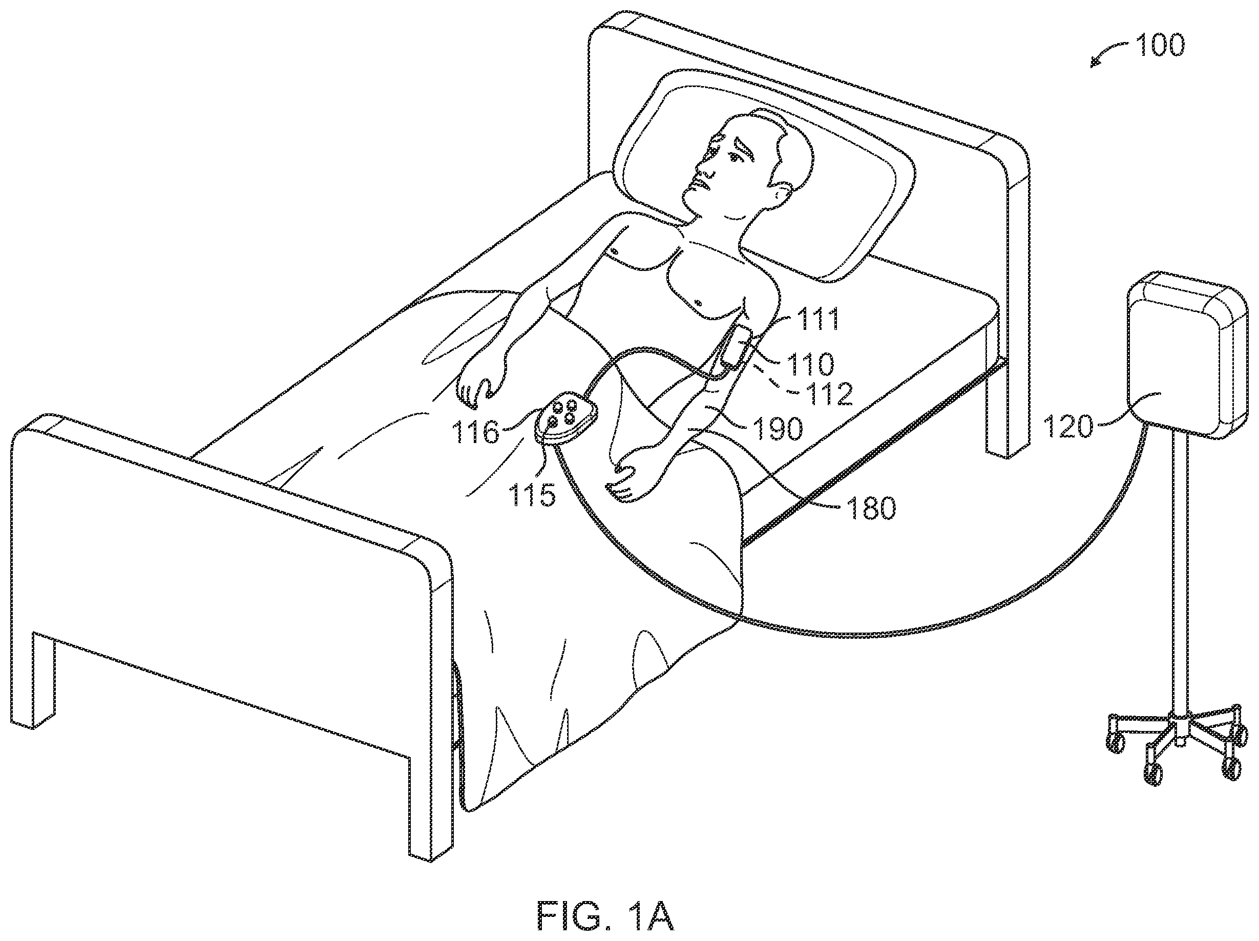Patent US12324704 — Securement of hands-free ultrasound probe — Figure 1