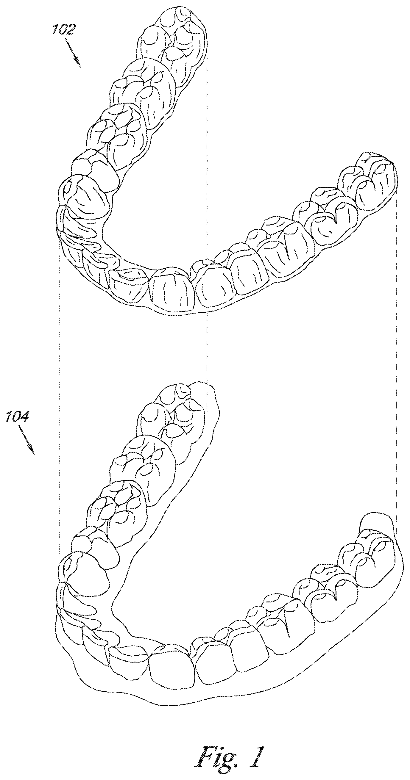 Patent US12324720 — Bite setting for dental treatment planning — Figure 1