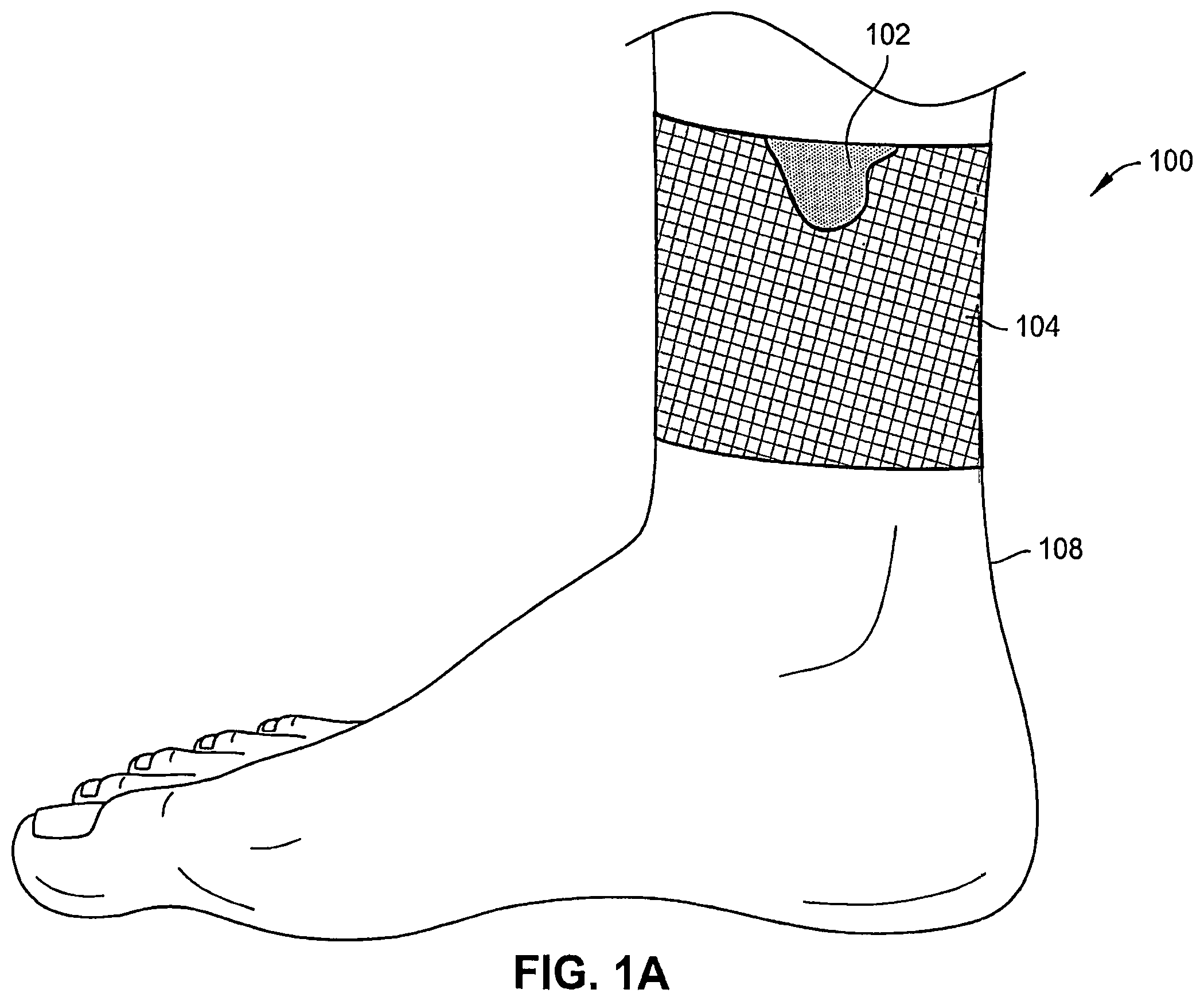 Patent US12324726 Figure 1 – Wound dressing garments, kits, systems, and methods