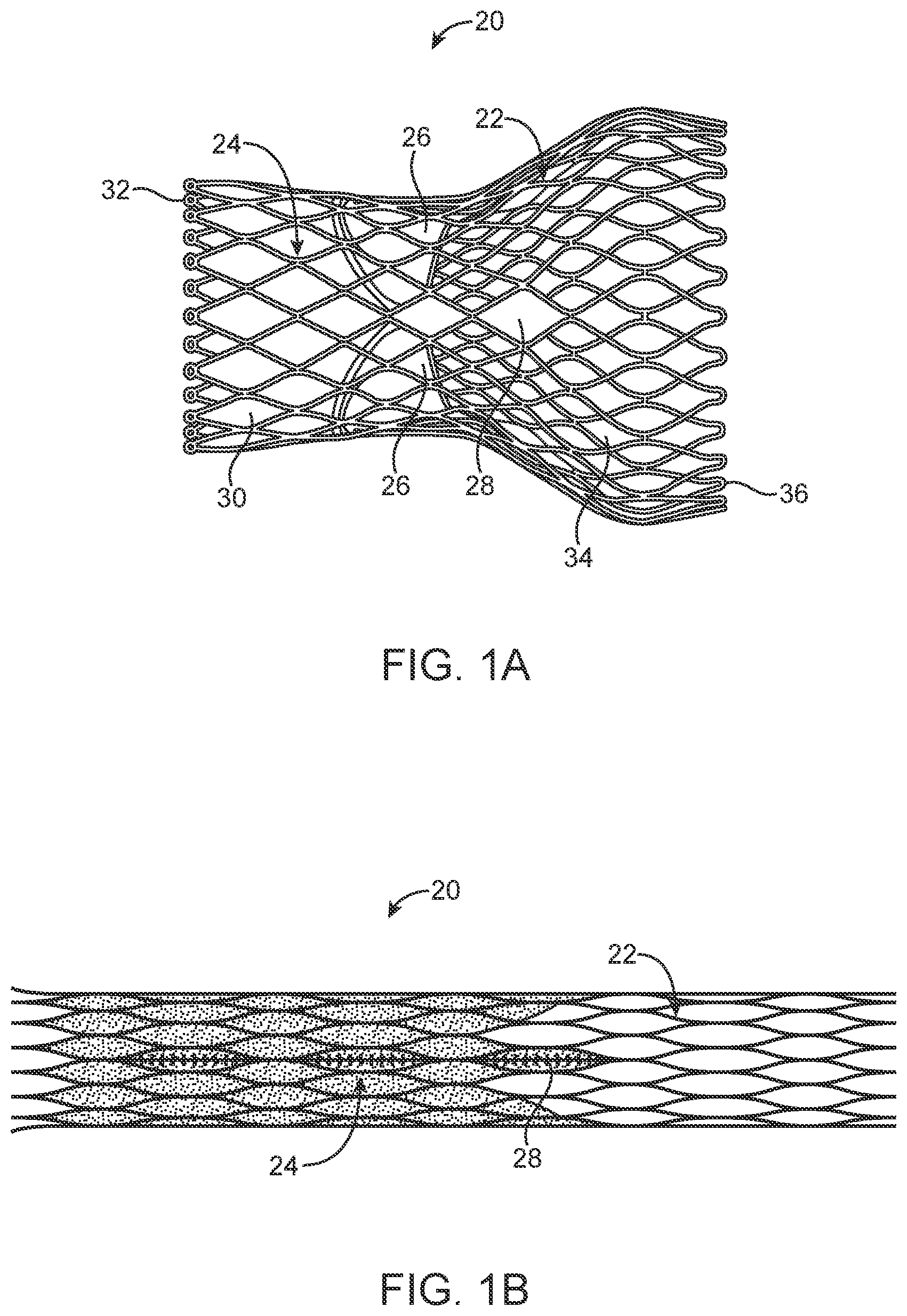 Patent US12324736 — Stented prosthetic heart valve with variable stiffness and methods of use — Figure 1
