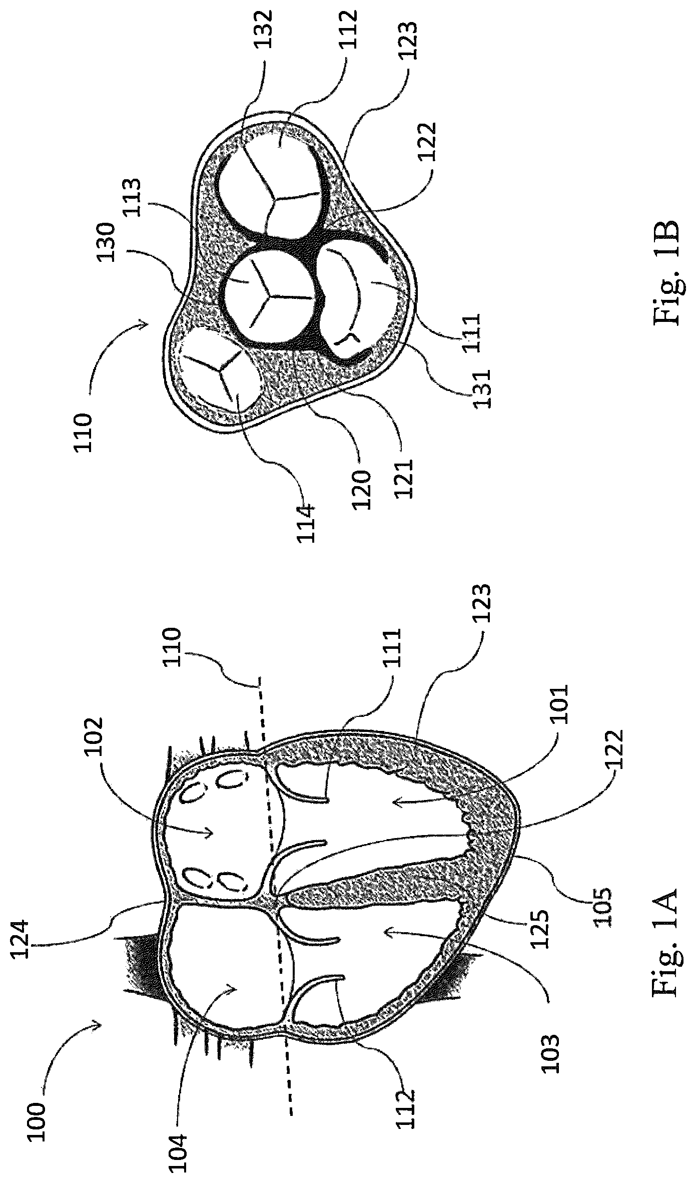 Patent US12324741 — Medical chamber system, introduction system and kit — Figure 1