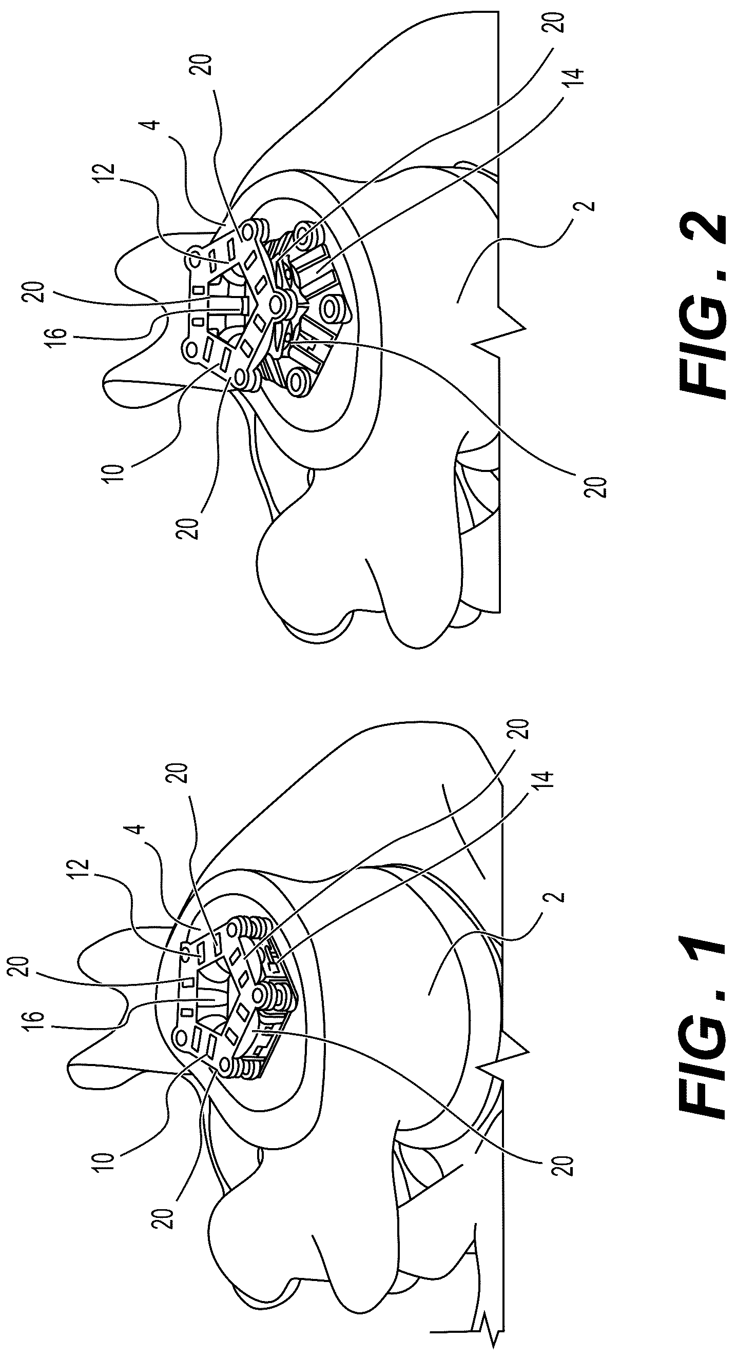 Patent US12324745 — Articulating expandable interbody fusions devices — Figure 1