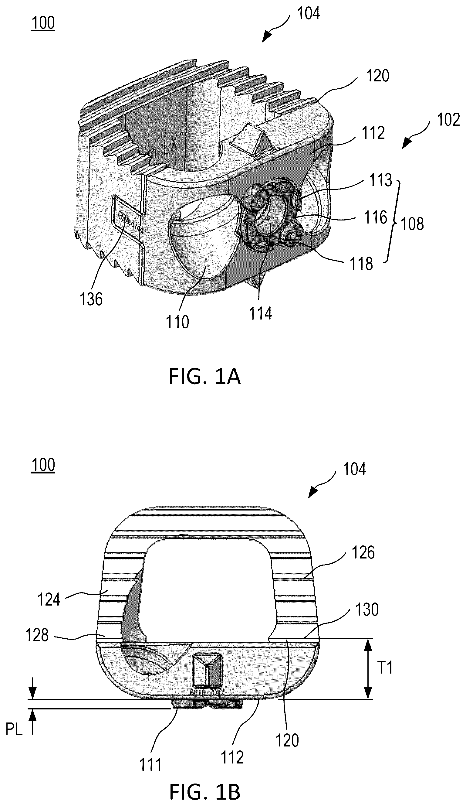 Patent US12324746 — Implant, system including implant, and method of using system — Figure 1