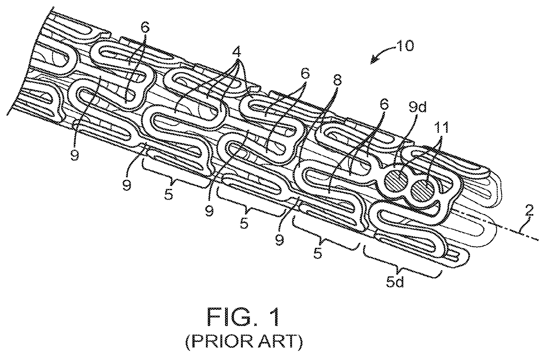 Patent US12324755 — Scaffolds having a radiopaque marker and methods for attaching a marker to a scaffold — Figure 1