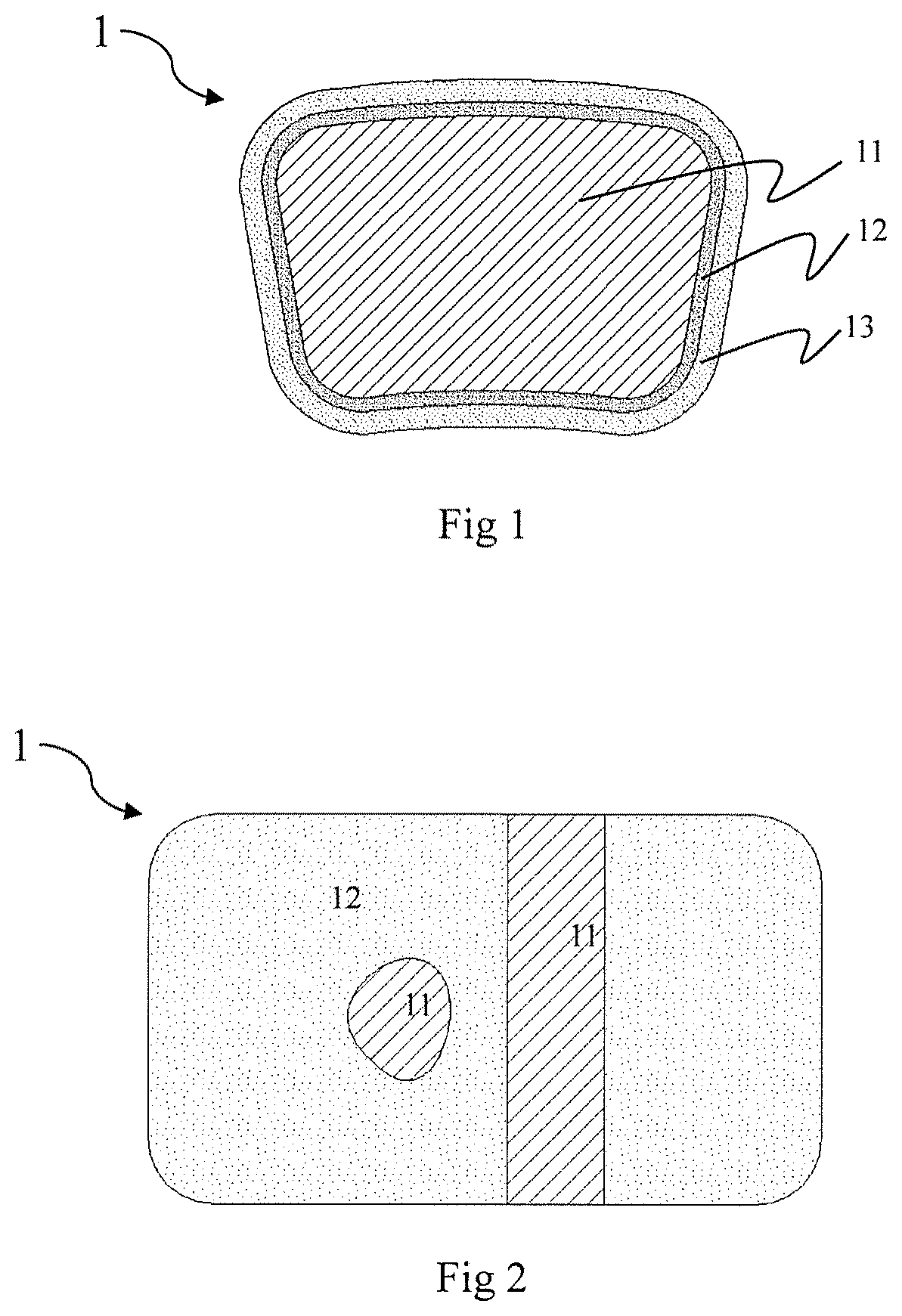 Patent US12324871 — Absorbable iron-based alloy implanted medical device and manufacturing method thereof — Figure 1