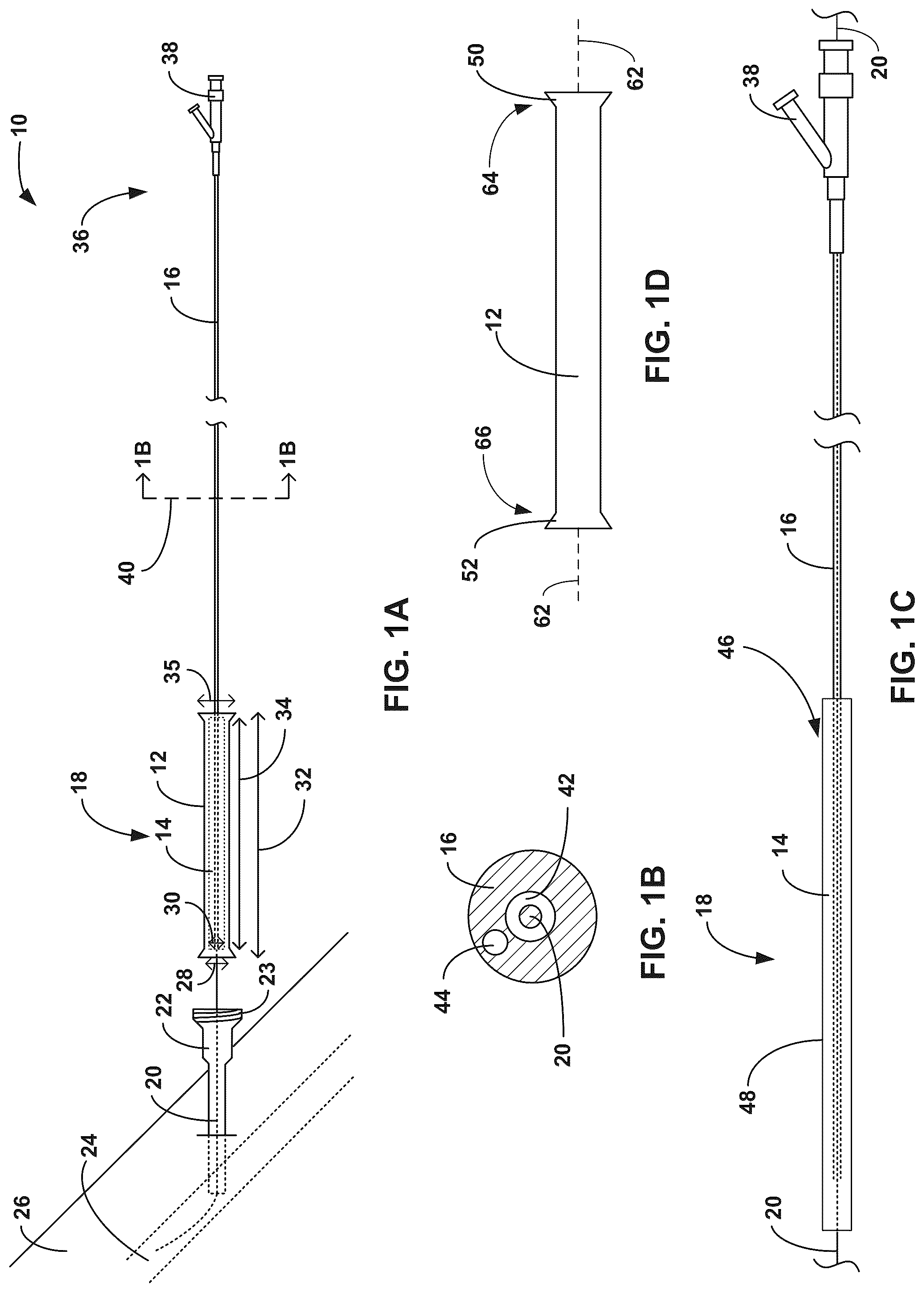 Patent US12324883 — Expandable balloon sheaths — Figure 1