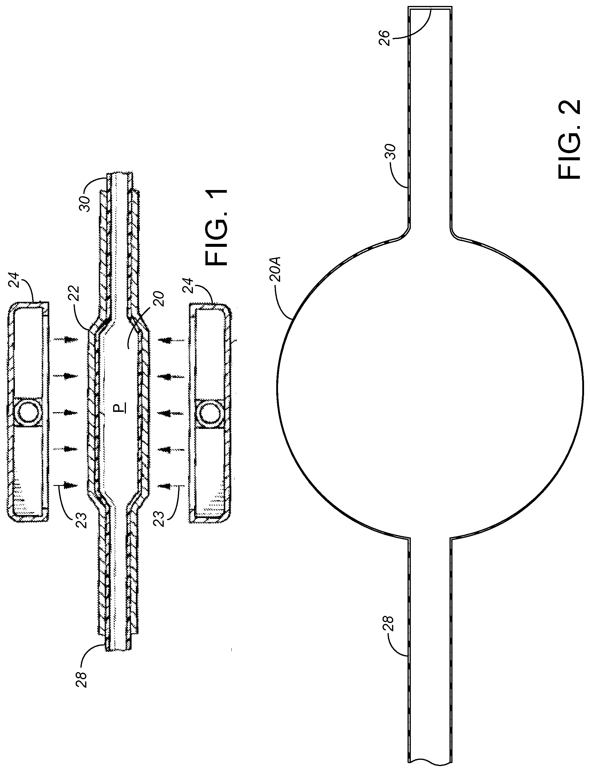 Patent US12324887 — Microminiature patterned metal on medical grade balloons — Figure 1