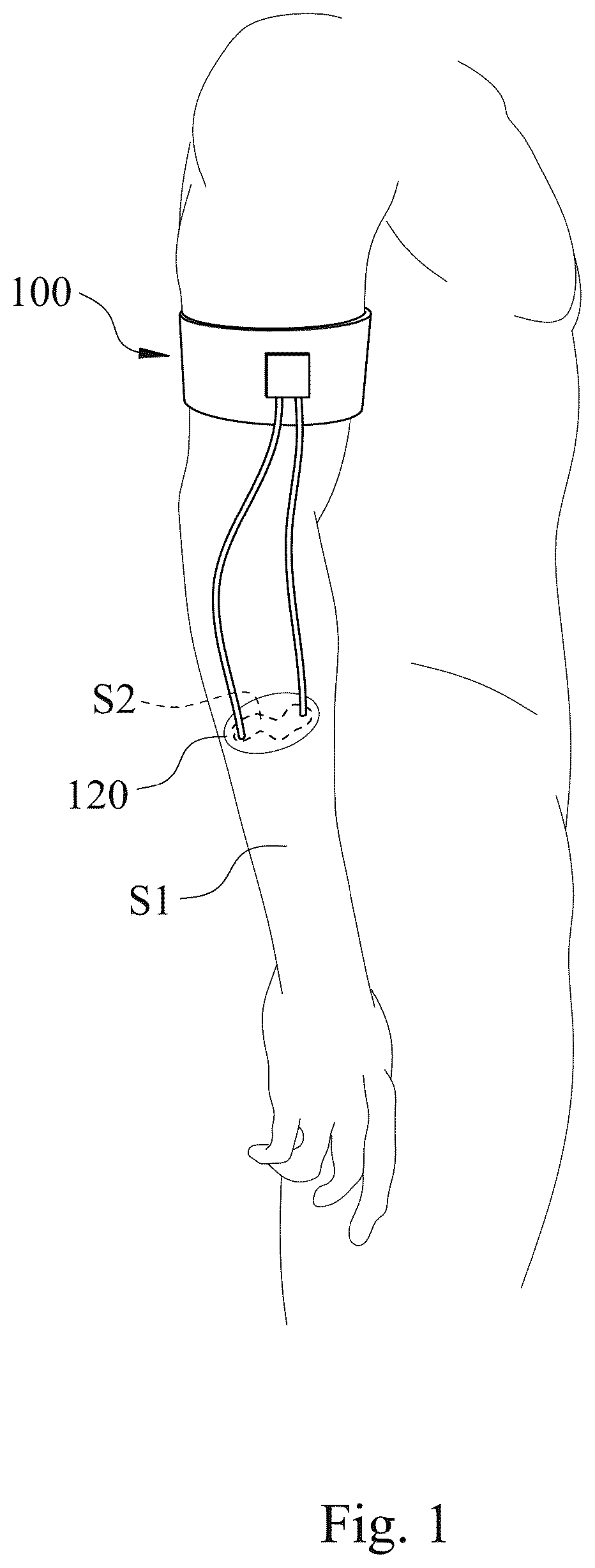 Patent US12324908 — Thermoelectric driving wearable system — Figure 1