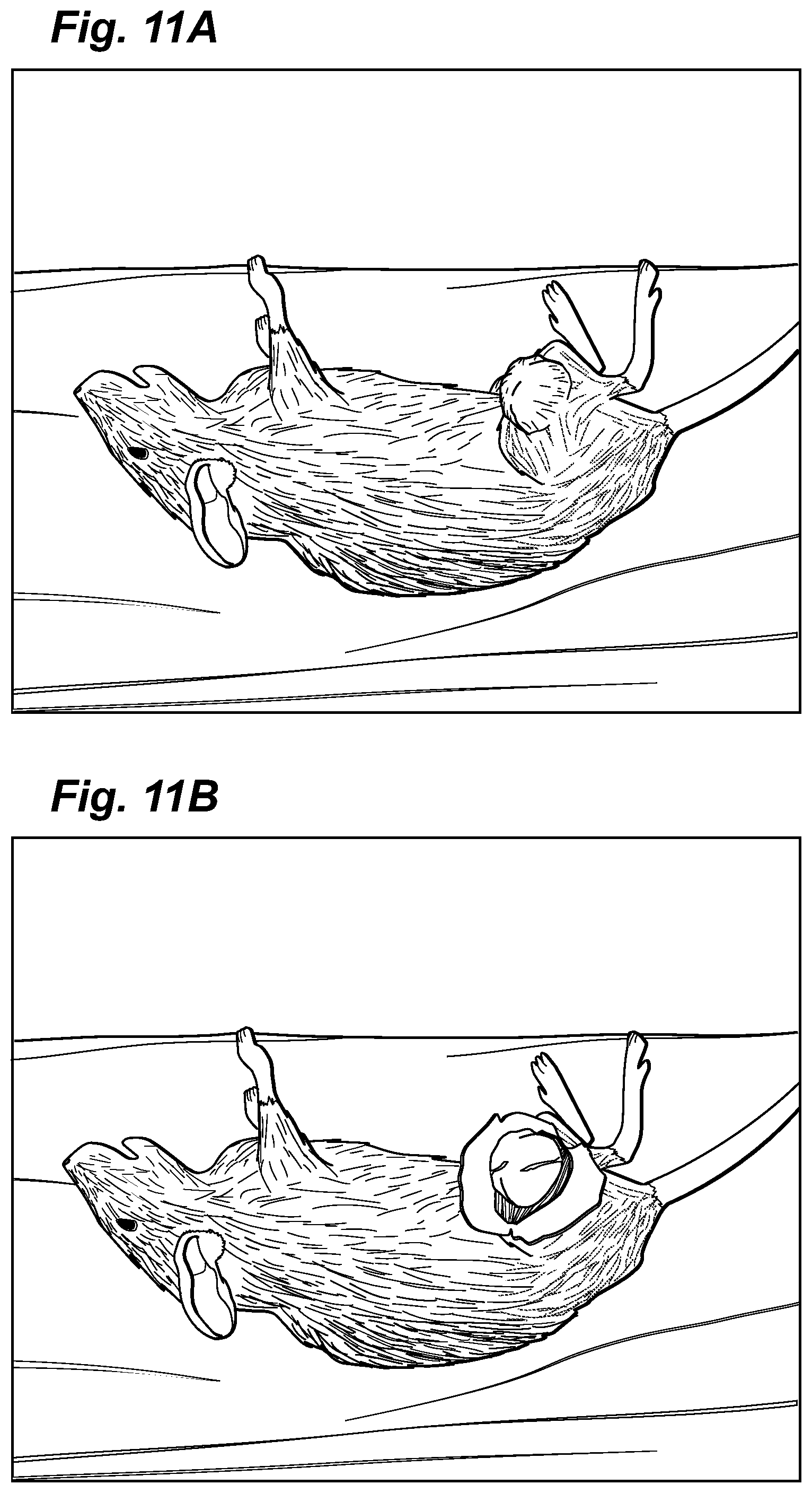 Patent US12324913 Figure 10 – Method and device for treating microscopic residual tumors remaining in tissues following surgical resection