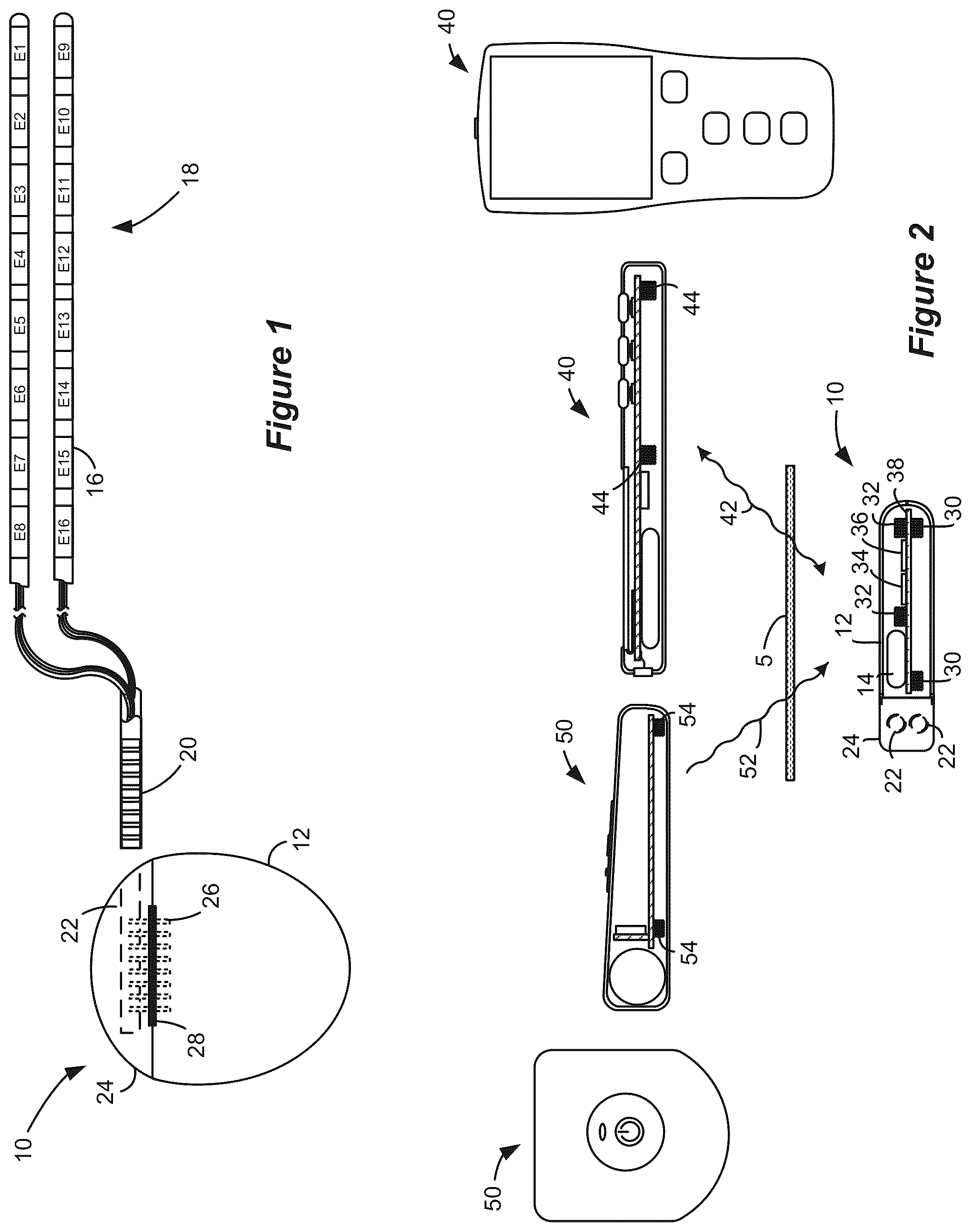 Patent US12324917 — System to optimize anodic stimulation modes — Figure 1