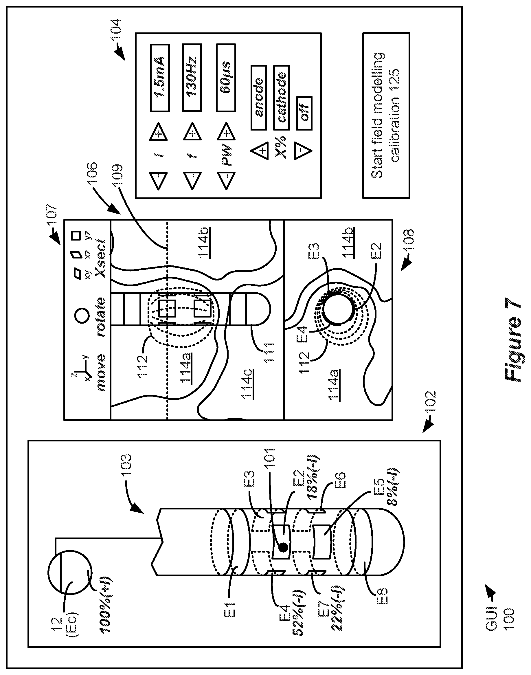 Patent US12324918 Figure 5 – Methods and systems for lead movement detection and response in DBS therapy