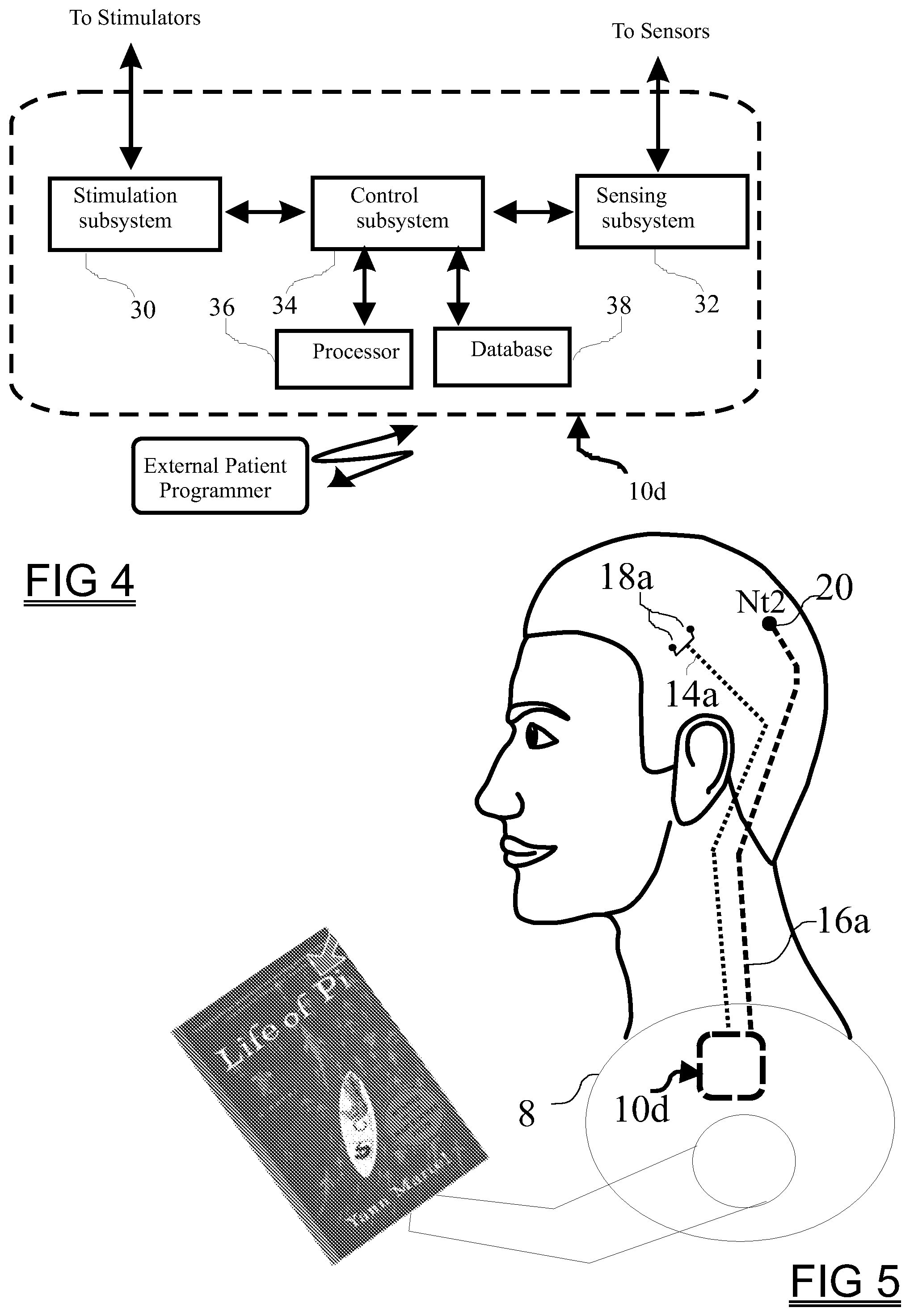 Patent US12324924 Figure 9 – Neurostimulation system with linked programming adjustment
