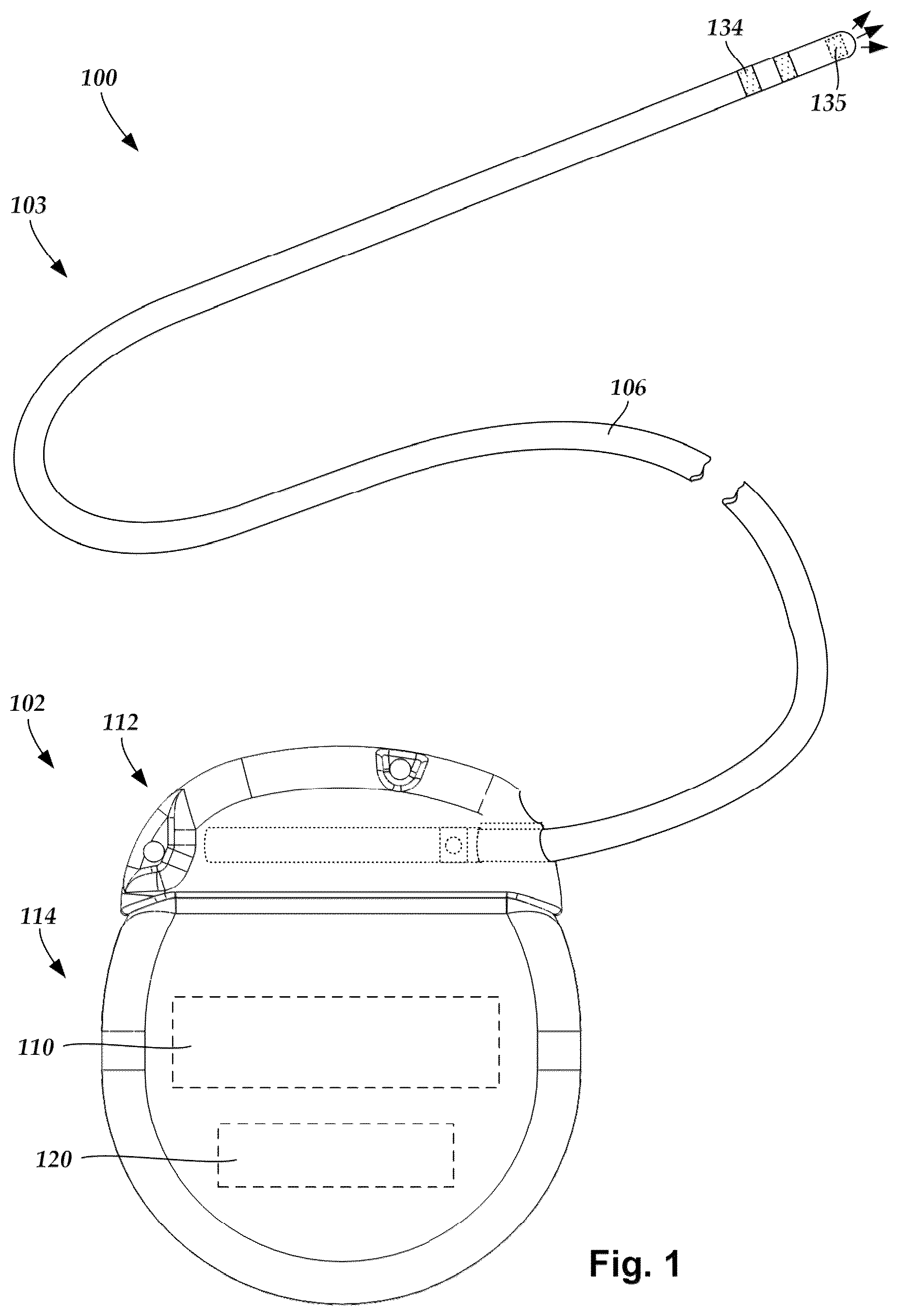 Patent US12324925 — Implantable optical stimulation lead and methods of making and using — Figure 1