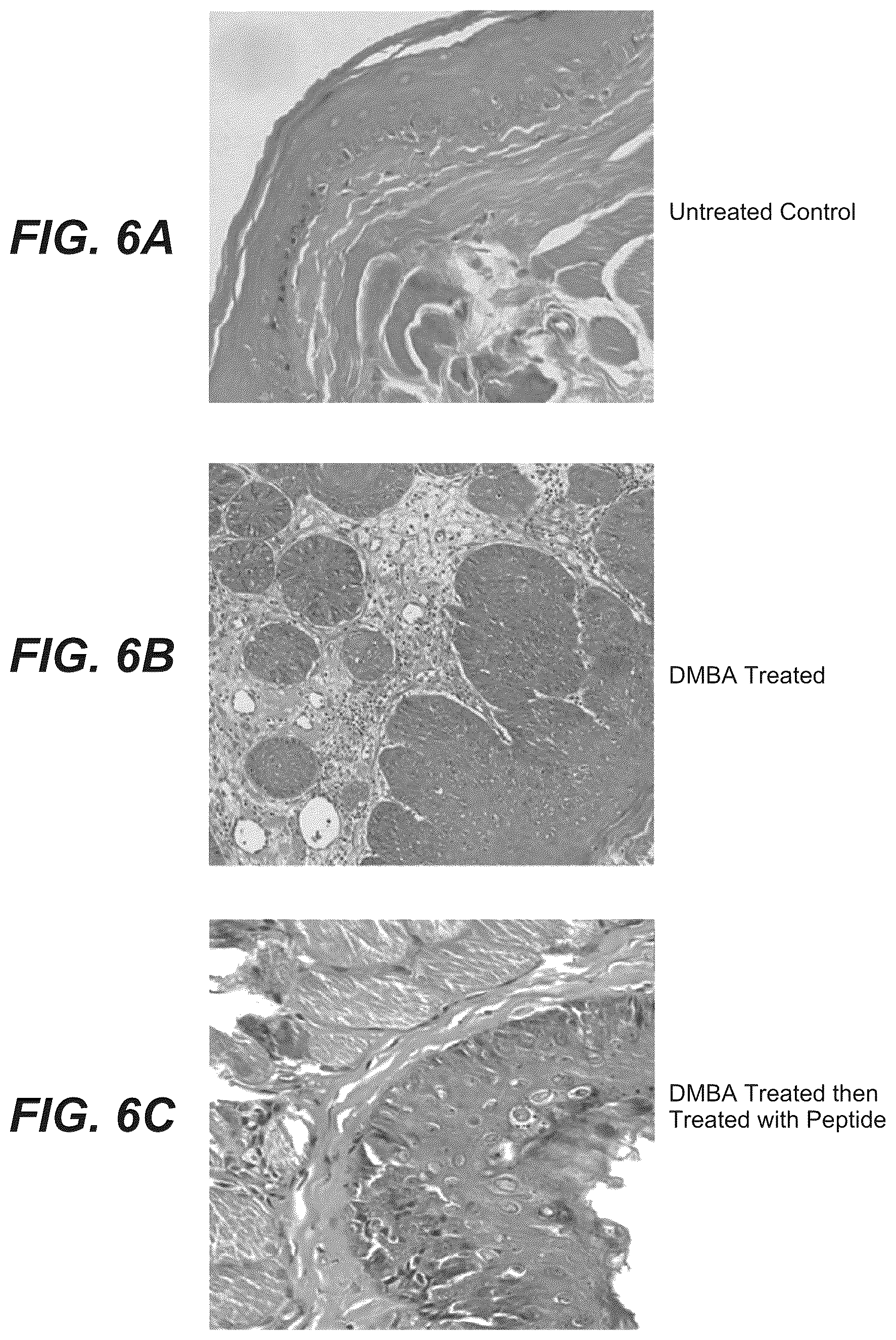 Patent US12325760 Figure 5 – Inhibitors of NF kappa-B activity for treatment of diseases and disorders
