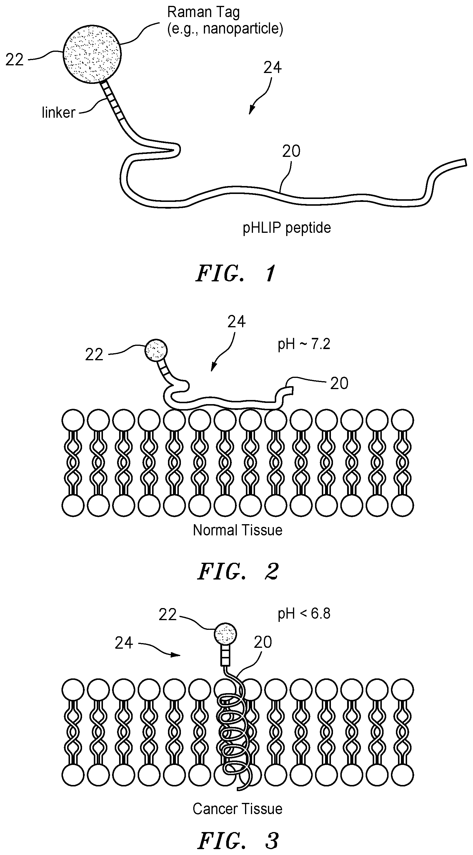 Patent US12326404 — Method and system for detecting cancerous tissue and tumor margin using raman spectroscopy — Figure 1